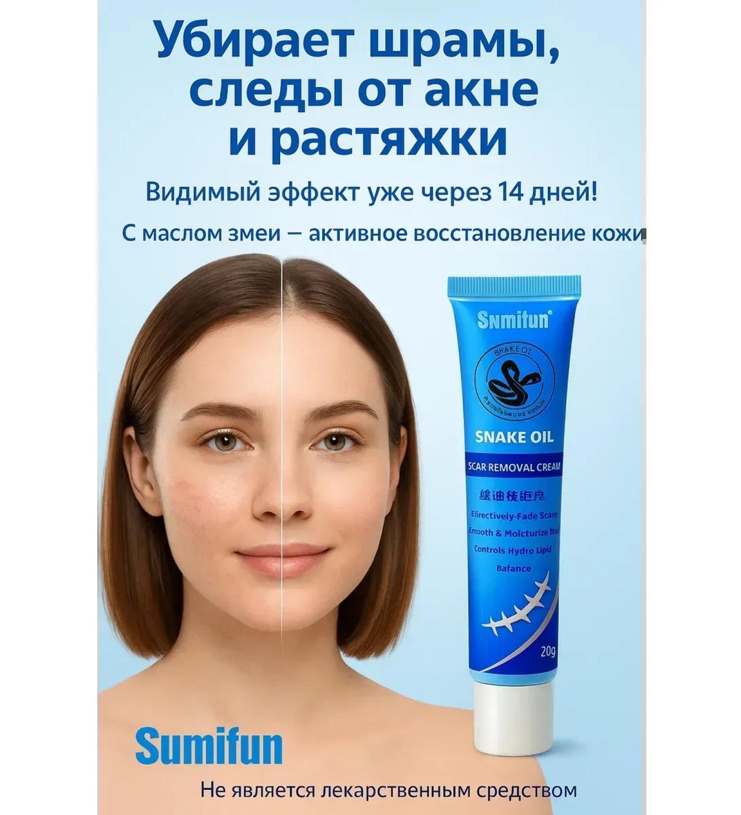 TRADE Cream for removing scars and scars 1 pc - Buy Online on GoSupps.com