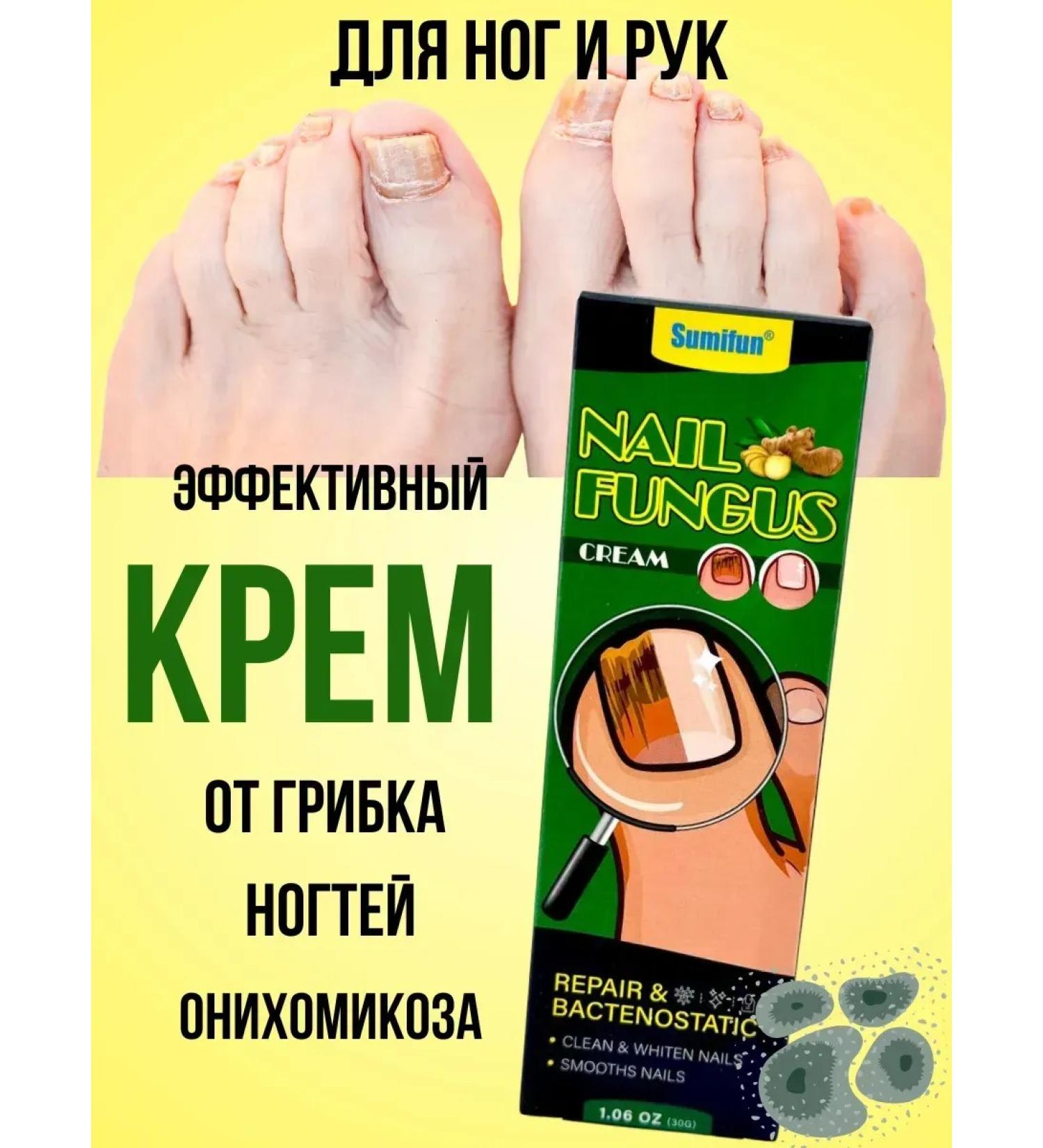 alma2 Cream from nail fungus for hands and legs Effective Chinese - Buy Online on GoSupps.com