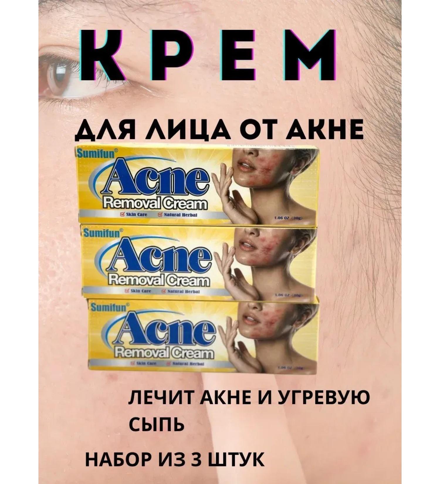 Natka intensive Acne cream - Buy Online on GoSupps.com