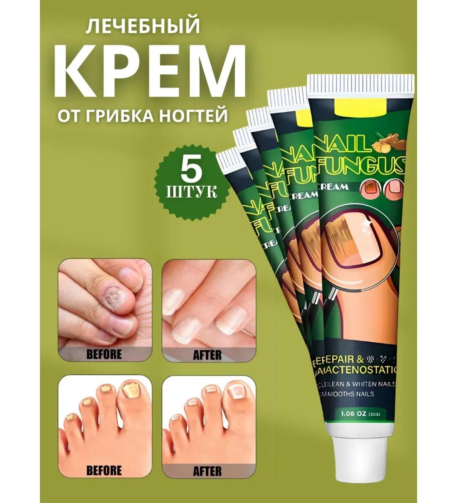 Barynch Cream from the fungus between the toes of the feet and from the nail fungus - Buy Online on GoSupps.com