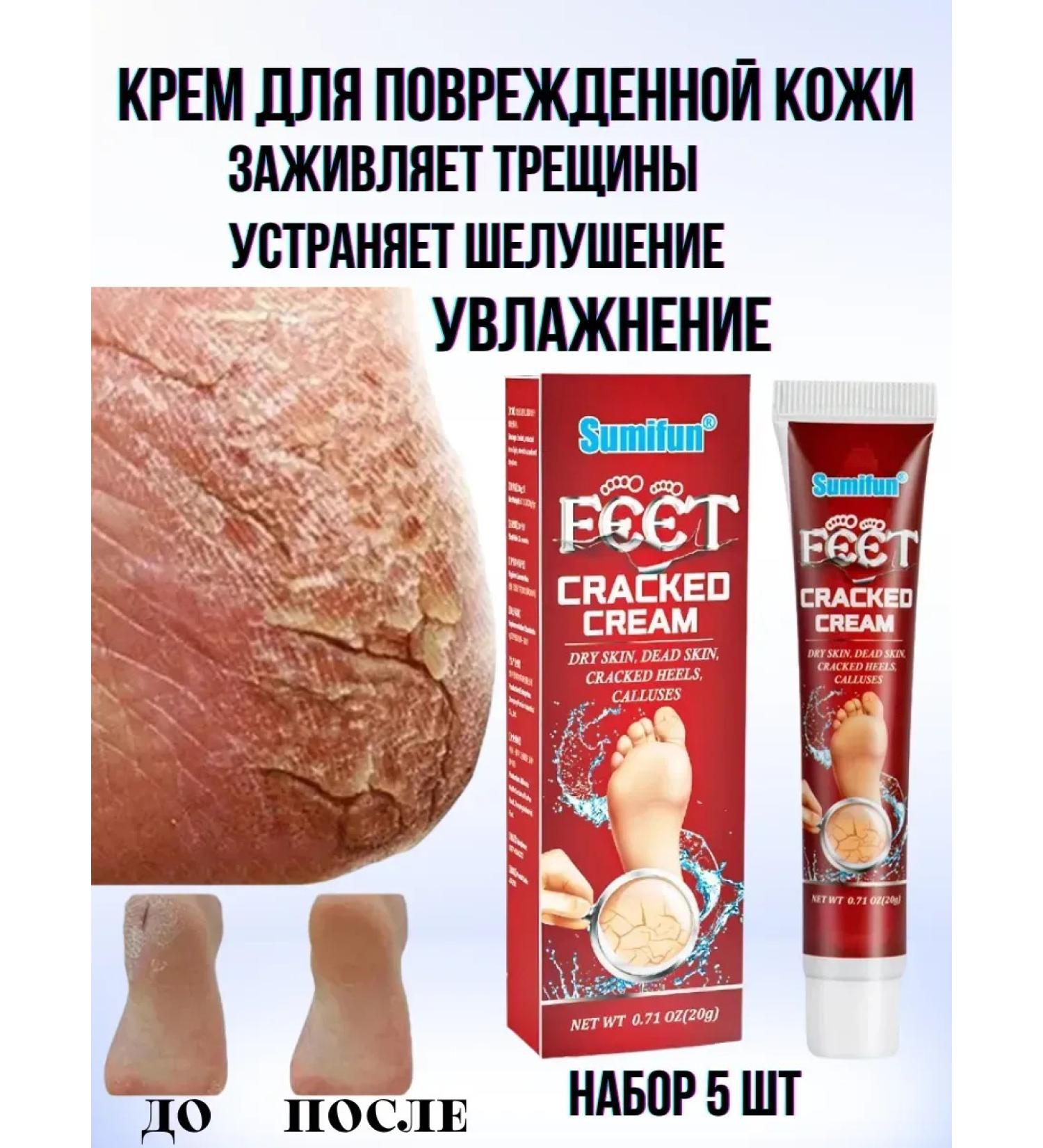 BESTQUALITY1 Cream for damaged skin from cracks peeling and dryness - Buy Online on GoSupps.com