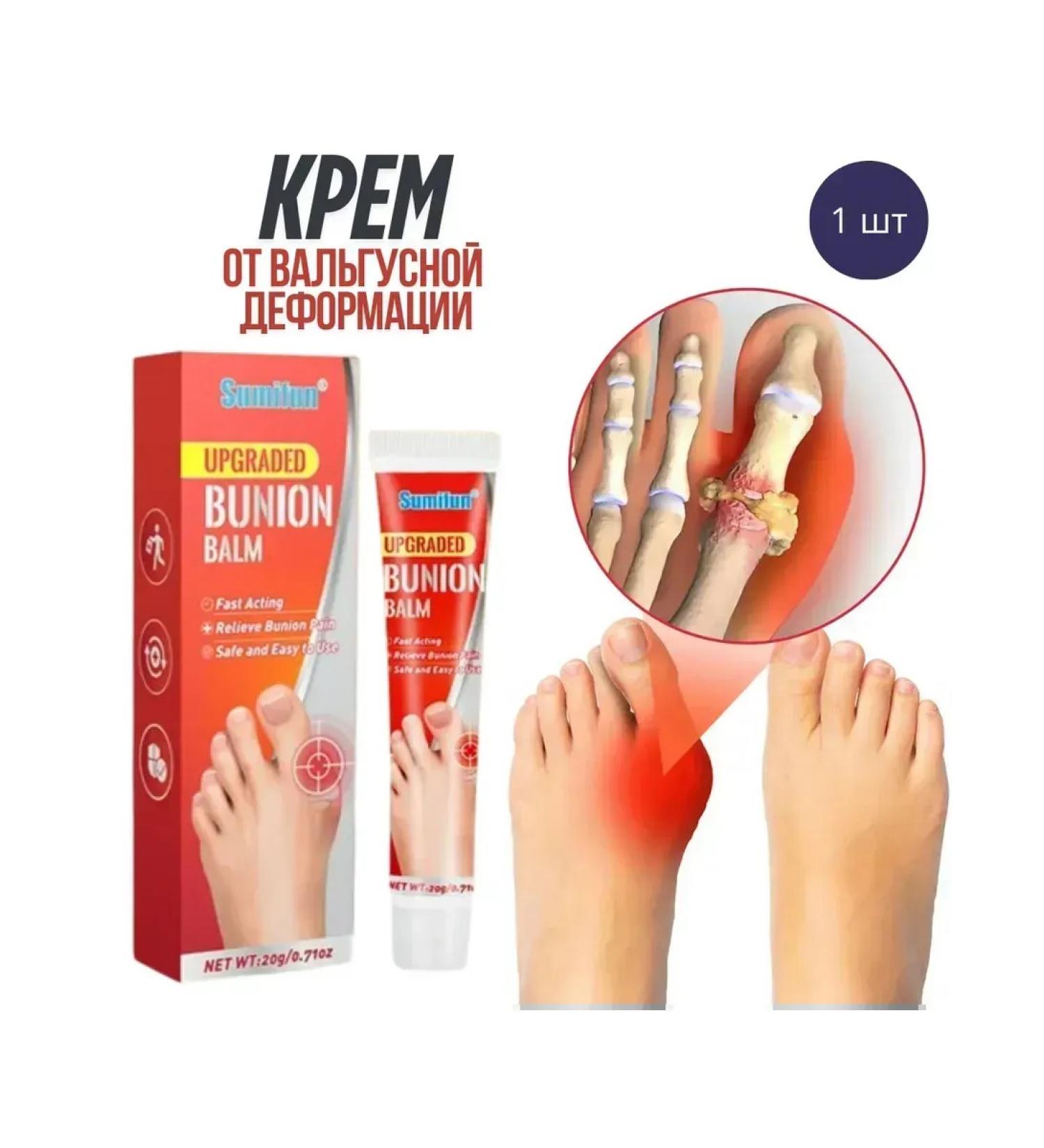 MaxWish 09 Cream for correction of valgus deformation of the toes 1pc - Buy Online on GoSupps.com