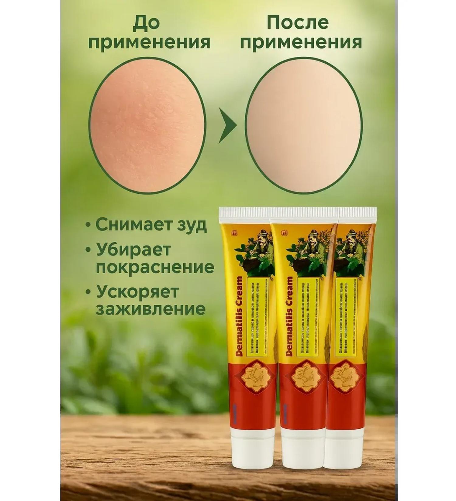 Veronya28 Beauty and Aesthetics Natural healing cream for skin itching rashes eczema 3 pcs. - Buy Online on GoSupps.com