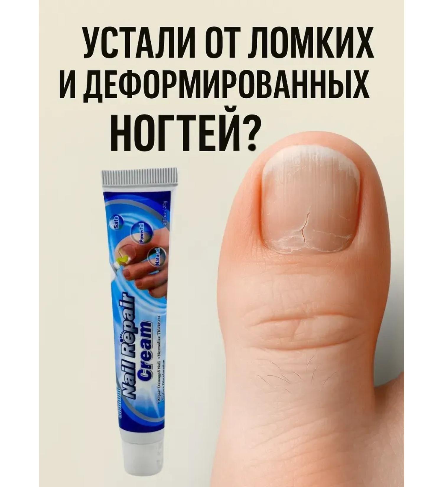 COME Medicated nail cream - Buy Online on GoSupps.com