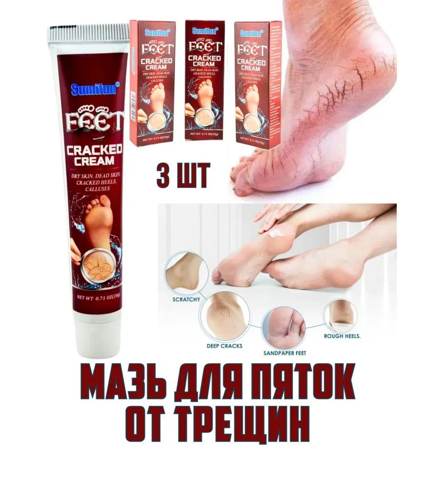 Dona7 Cream for softening the skin of the feet - Buy Online on GoSupps.com