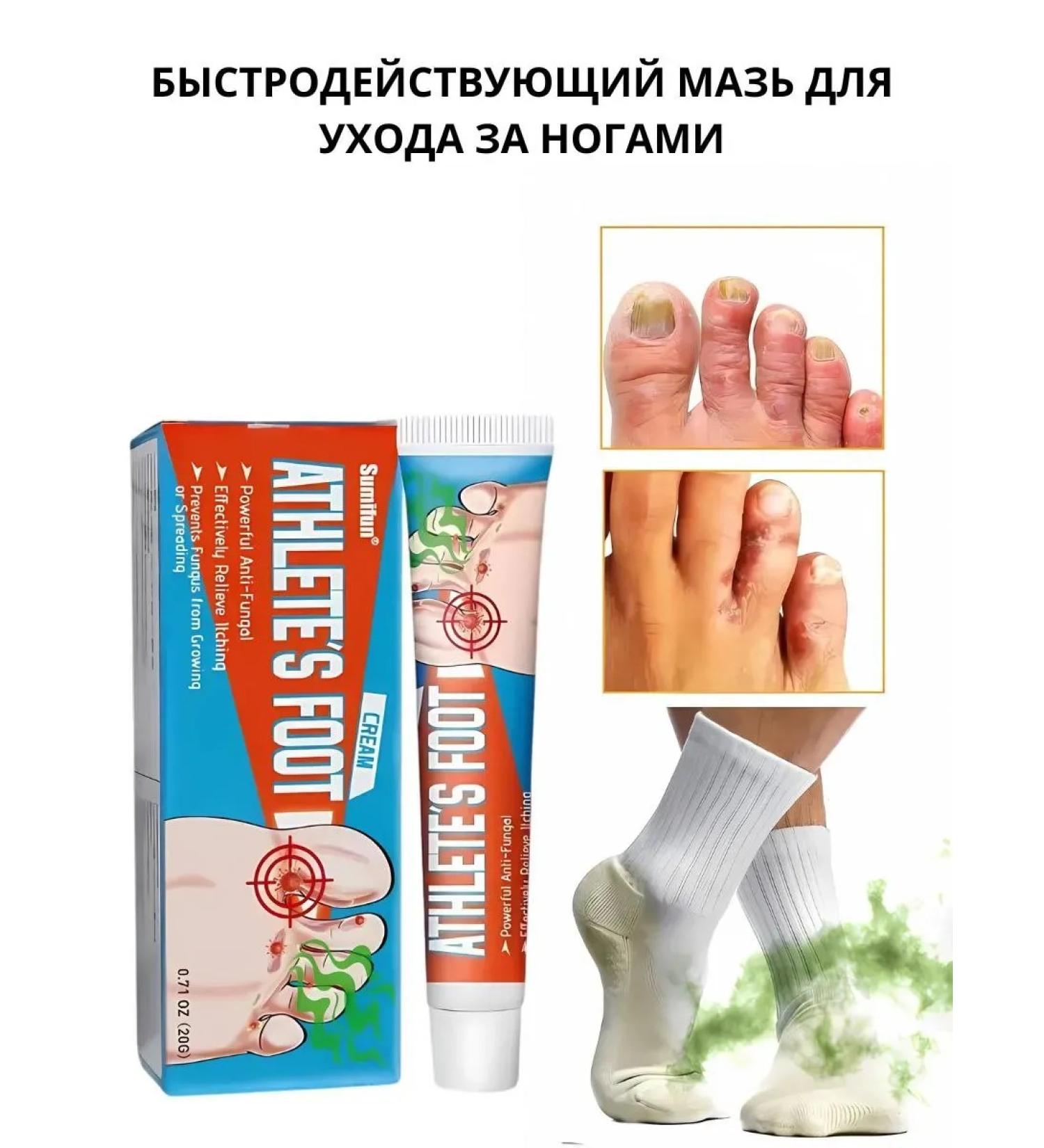 Barynch Ointment from the fungus between the fingers on the legs and feet and the smell of the legs - Buy Online on GoSupps.com