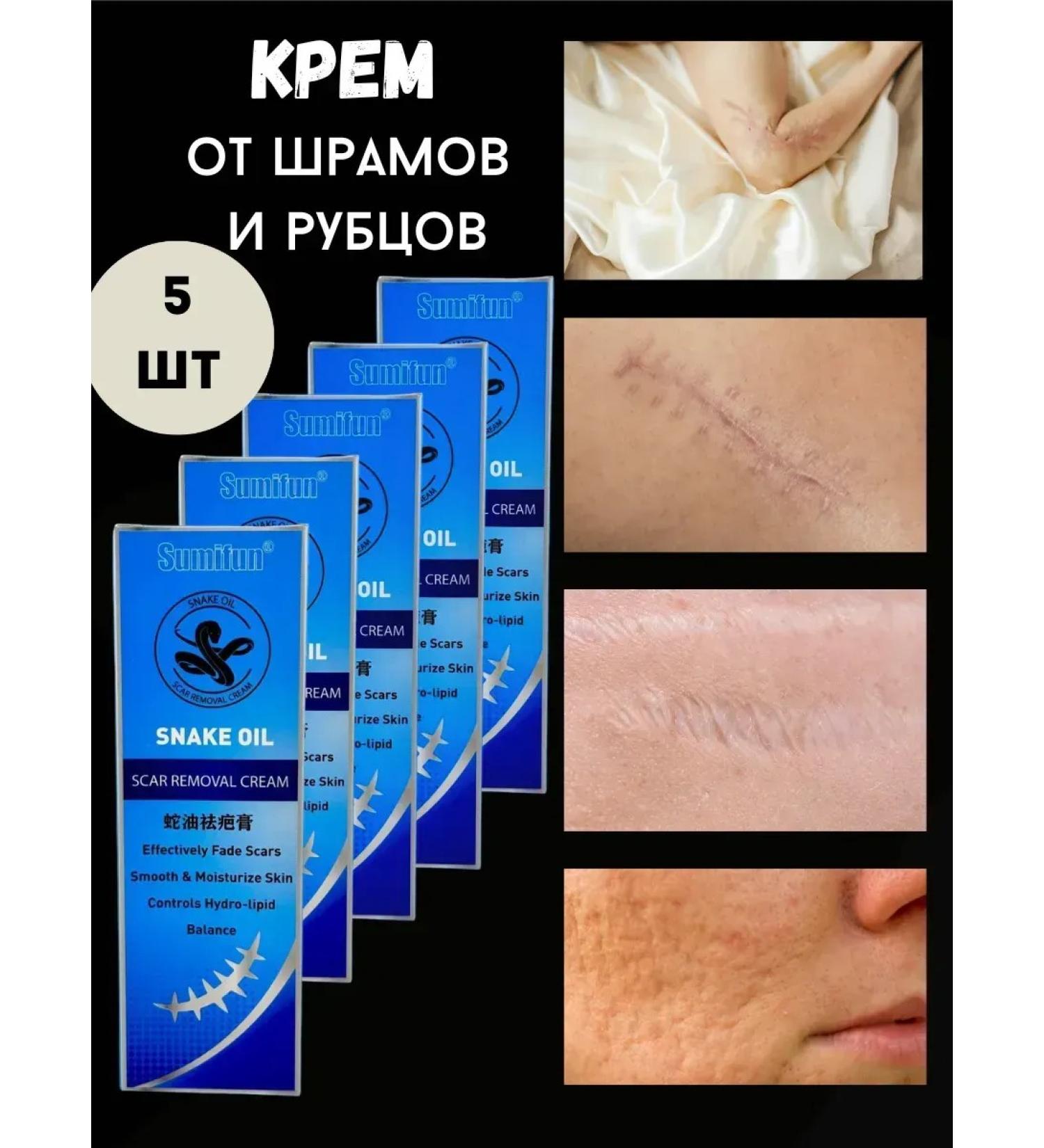 Kalis Cream ointment for removing scars and scars - Buy Online on GoSupps.com