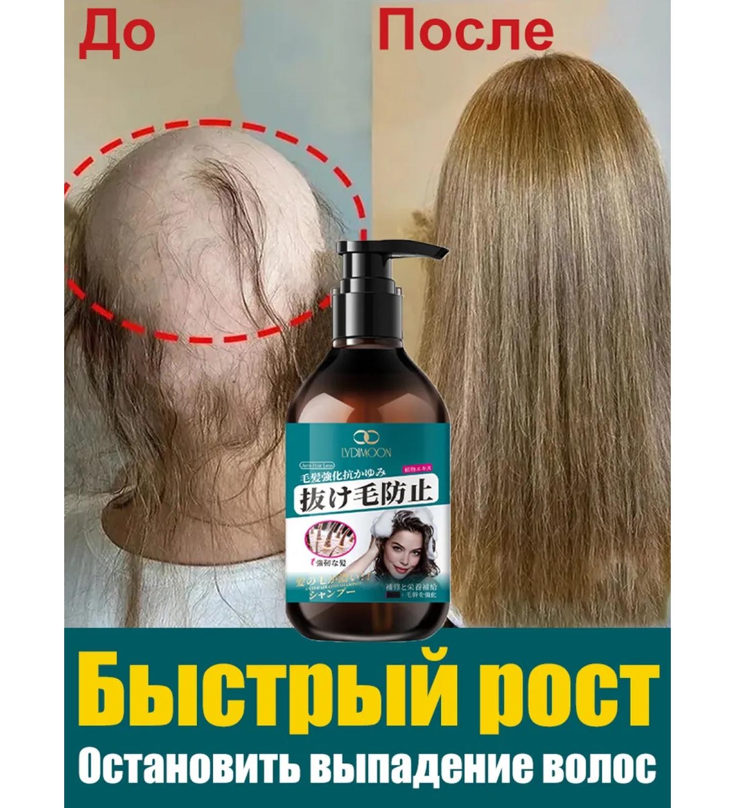 LYDIMOON Hair dropping shampoo and hair growth 300ml - Buy Online on GoSupps.com
