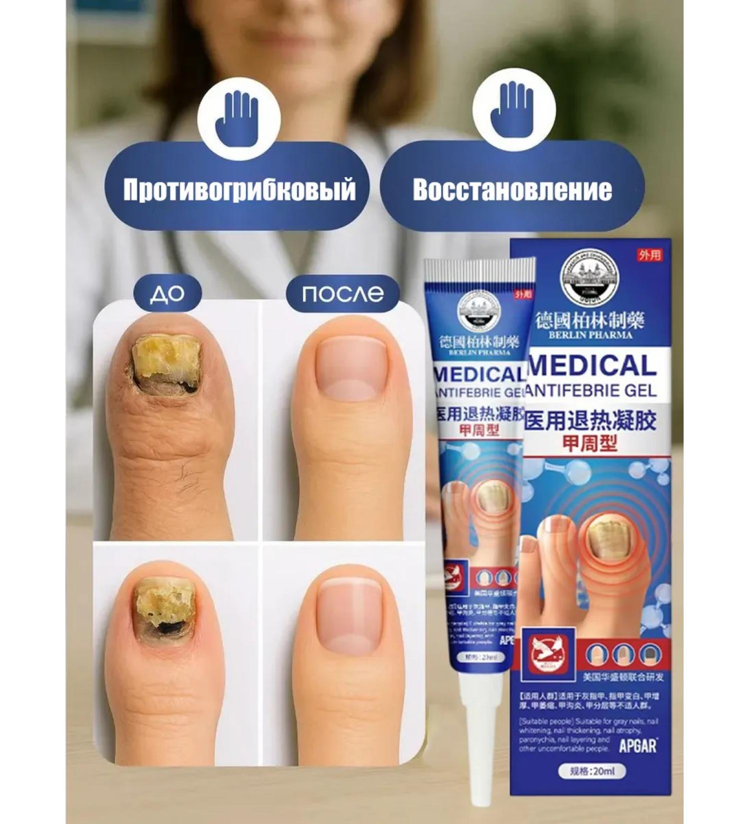 Chinese ointment from nail fungus 3 pcs - Buy Online on GoSupps.com