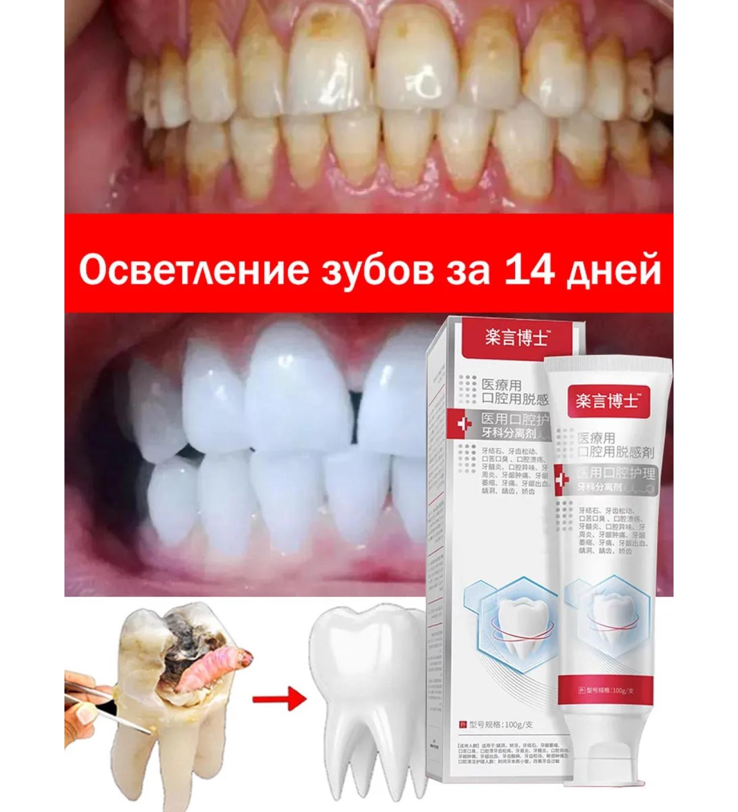 Toothpaste whitening from tea and tobacco with fluorine 3 pcs