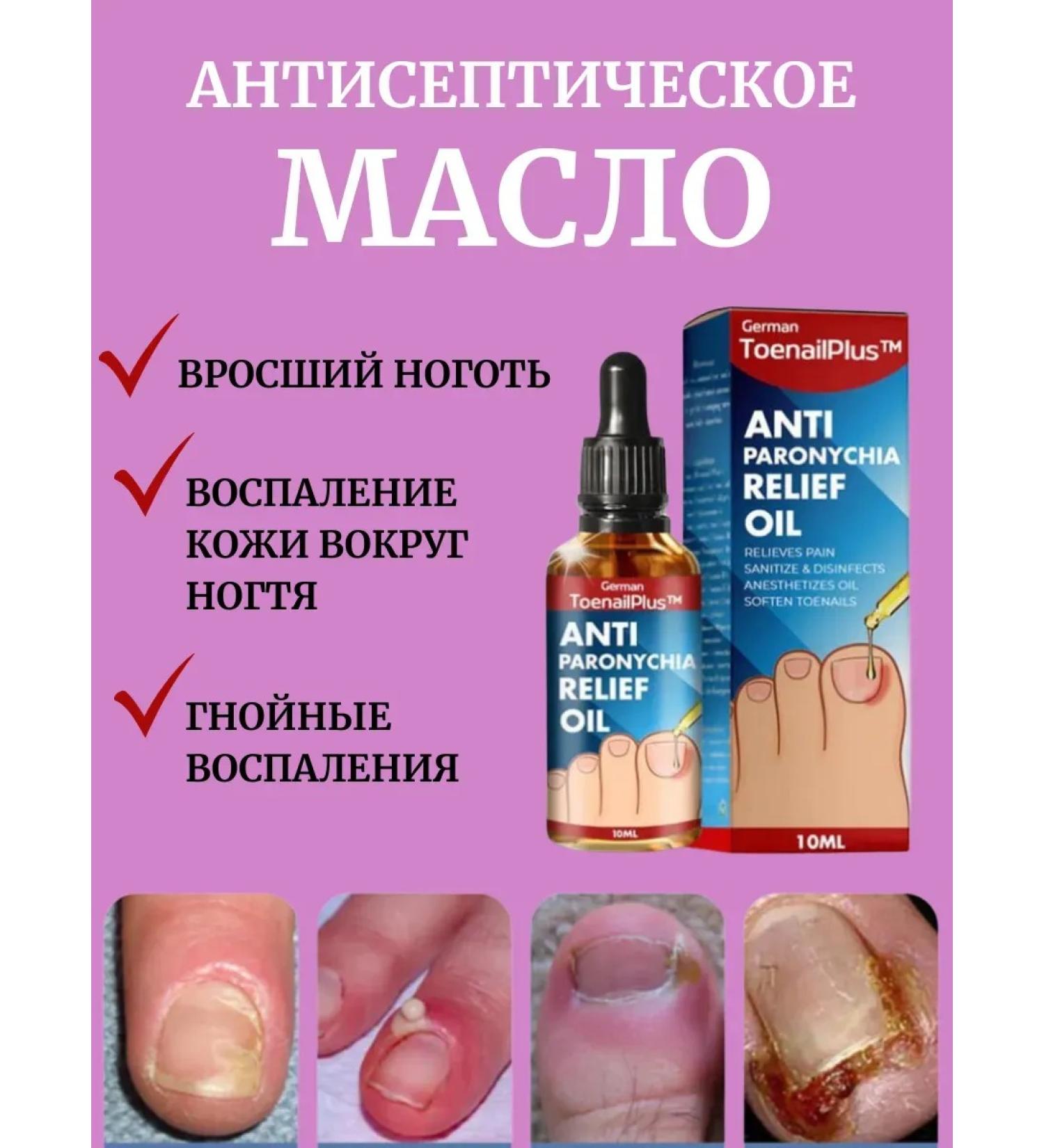 olgaintensive Oil with an ingrown nail and paronichia antiseptic+anesthetic - Buy Online on GoSupps.com