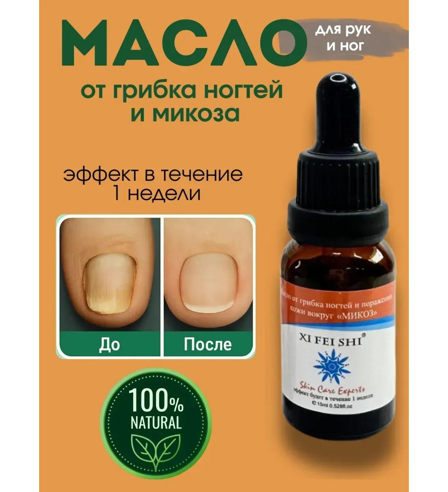 NevaNeva Oil fungus and mycosophage medicinal - Buy Online on GoSupps.com