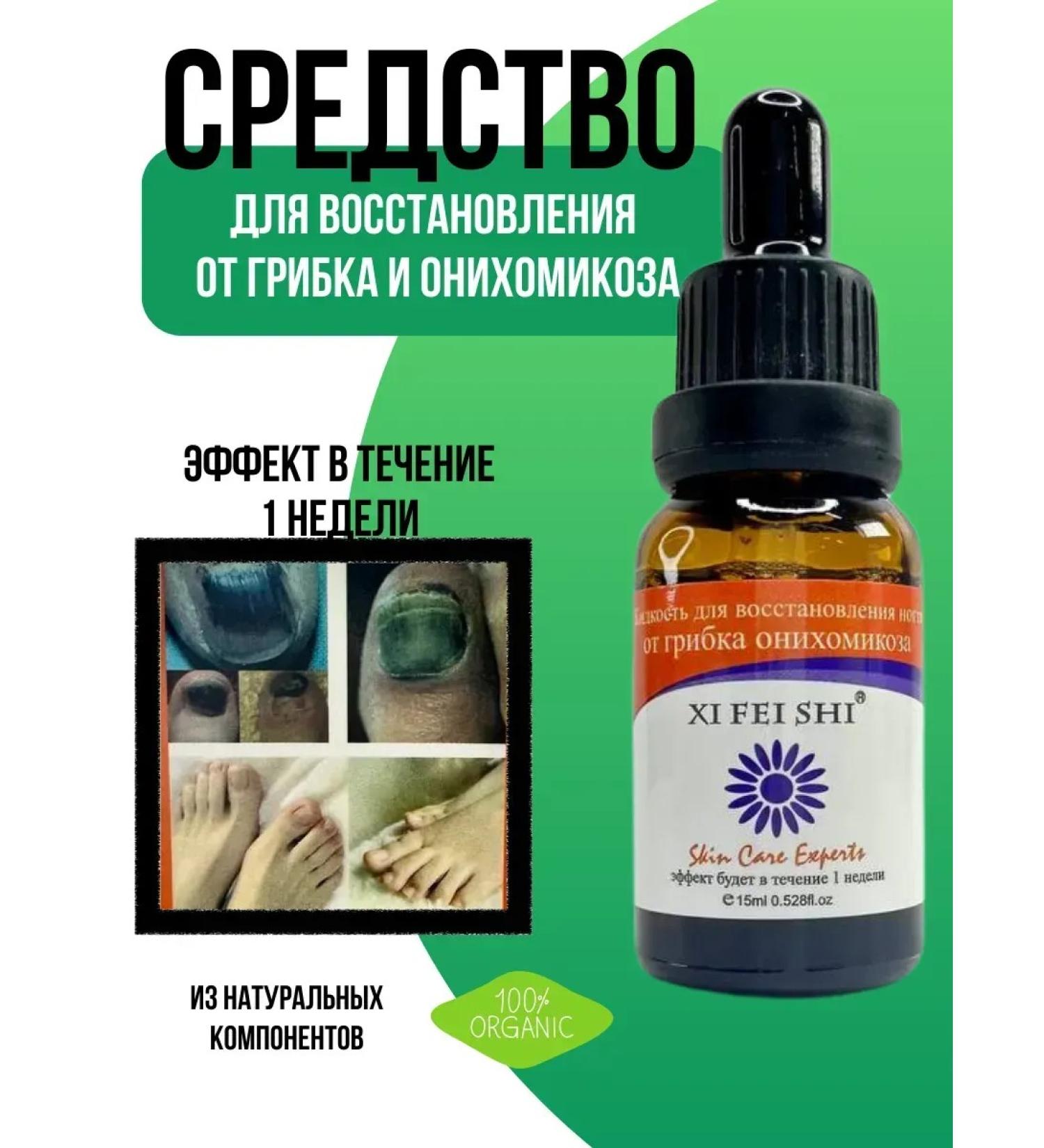 NevaRoomm Tool for restoration of the nail after fungus and onychomycosis - Buy Online on GoSupps.com