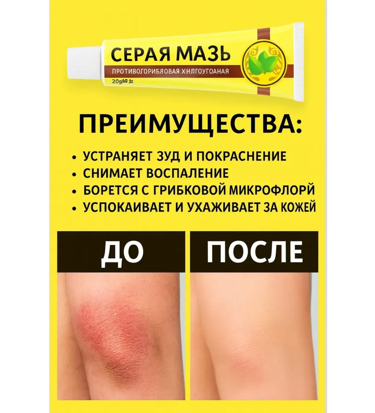 KikaIntensive Chinese ointment - Buy Online on GoSupps.com