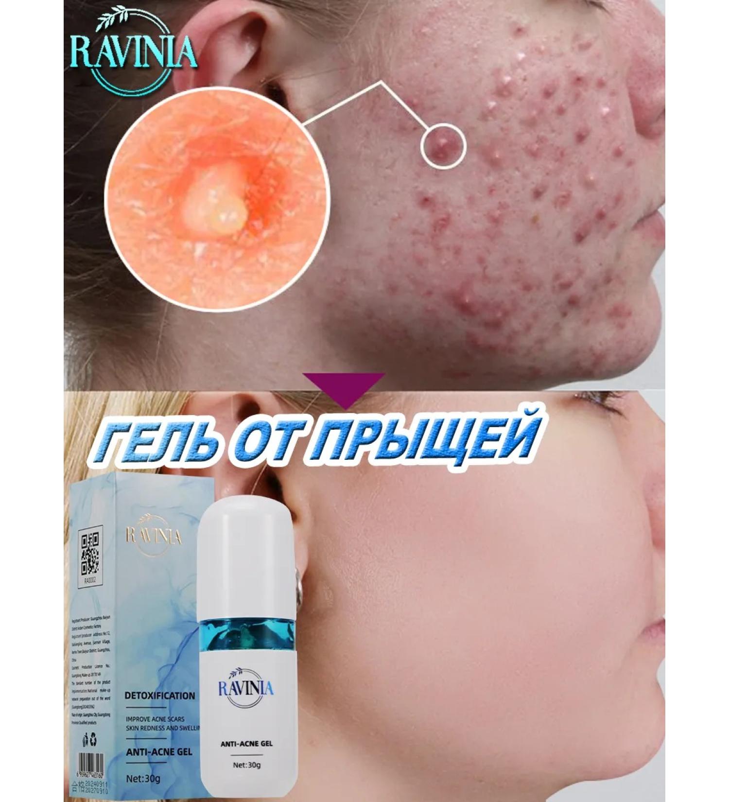 Poppy pimples 30 g of pimples of plant extract - Buy Online on GoSupps.com