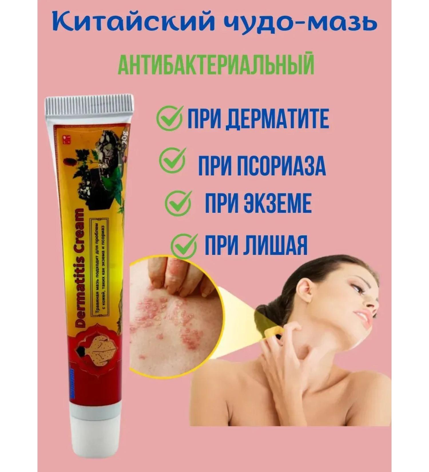 BiuG Ointment from seborrheic dermatitis with psoriasis - Buy Online on GoSupps.com