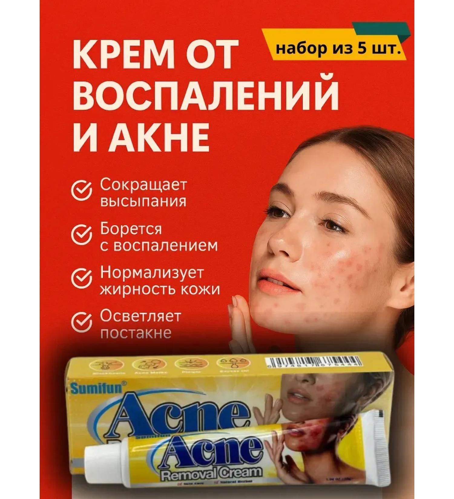Teon Acne and inflammation cream acne - Buy Online on GoSupps.com