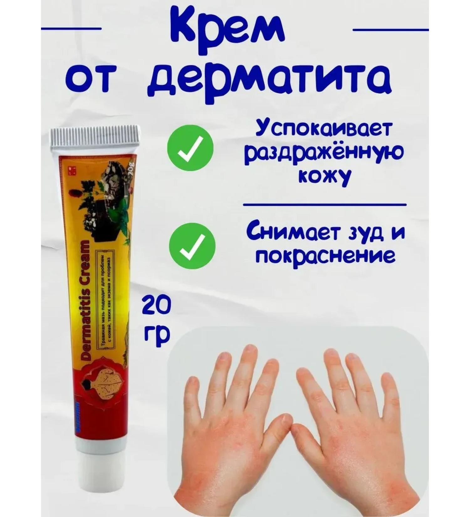 NT83 Cream from dermatitis and psoriasis - Buy Online on GoSupps.com