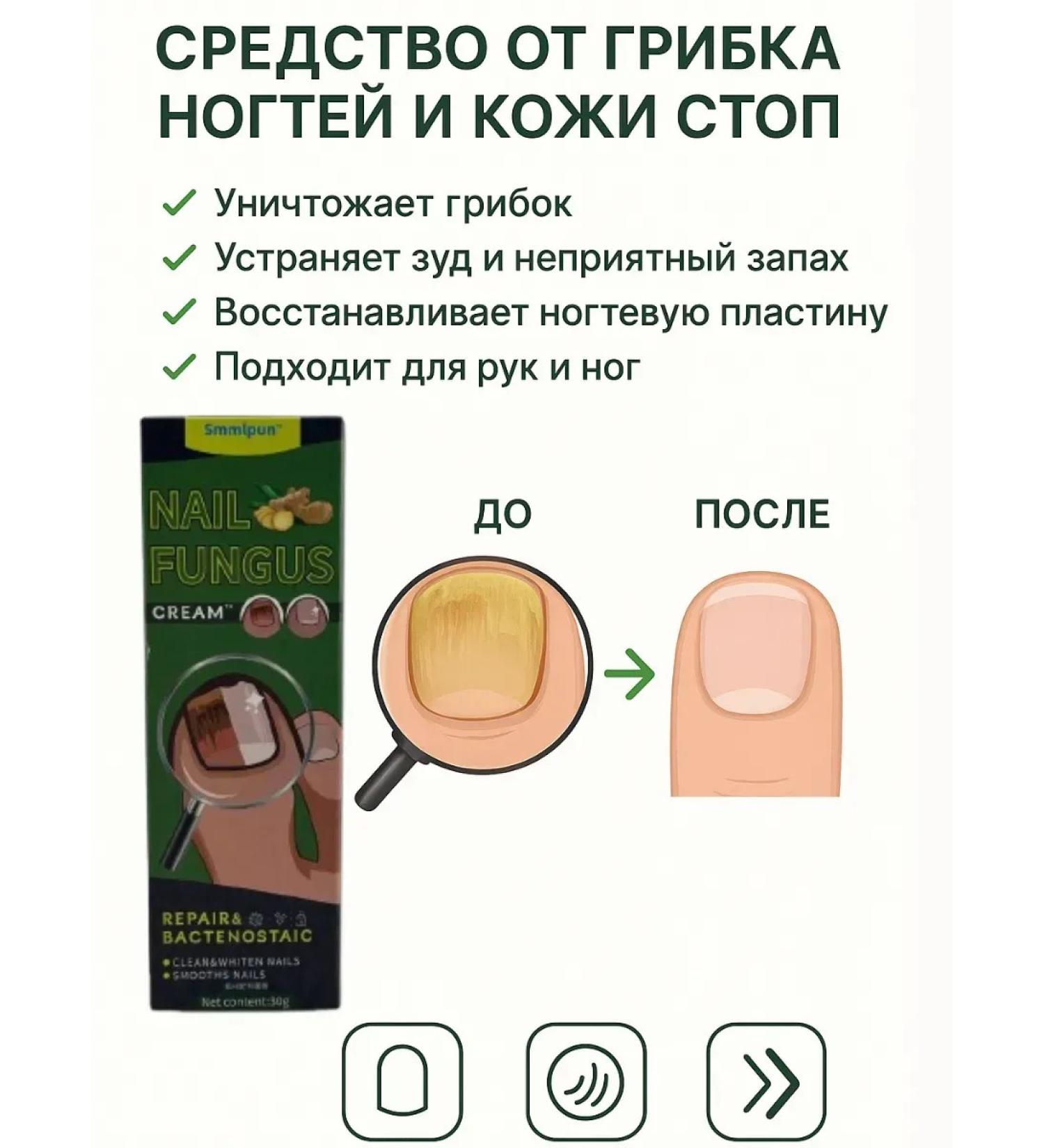 Zhyldyz Remedy for nail fungus and skin - Buy Online on GoSupps.com