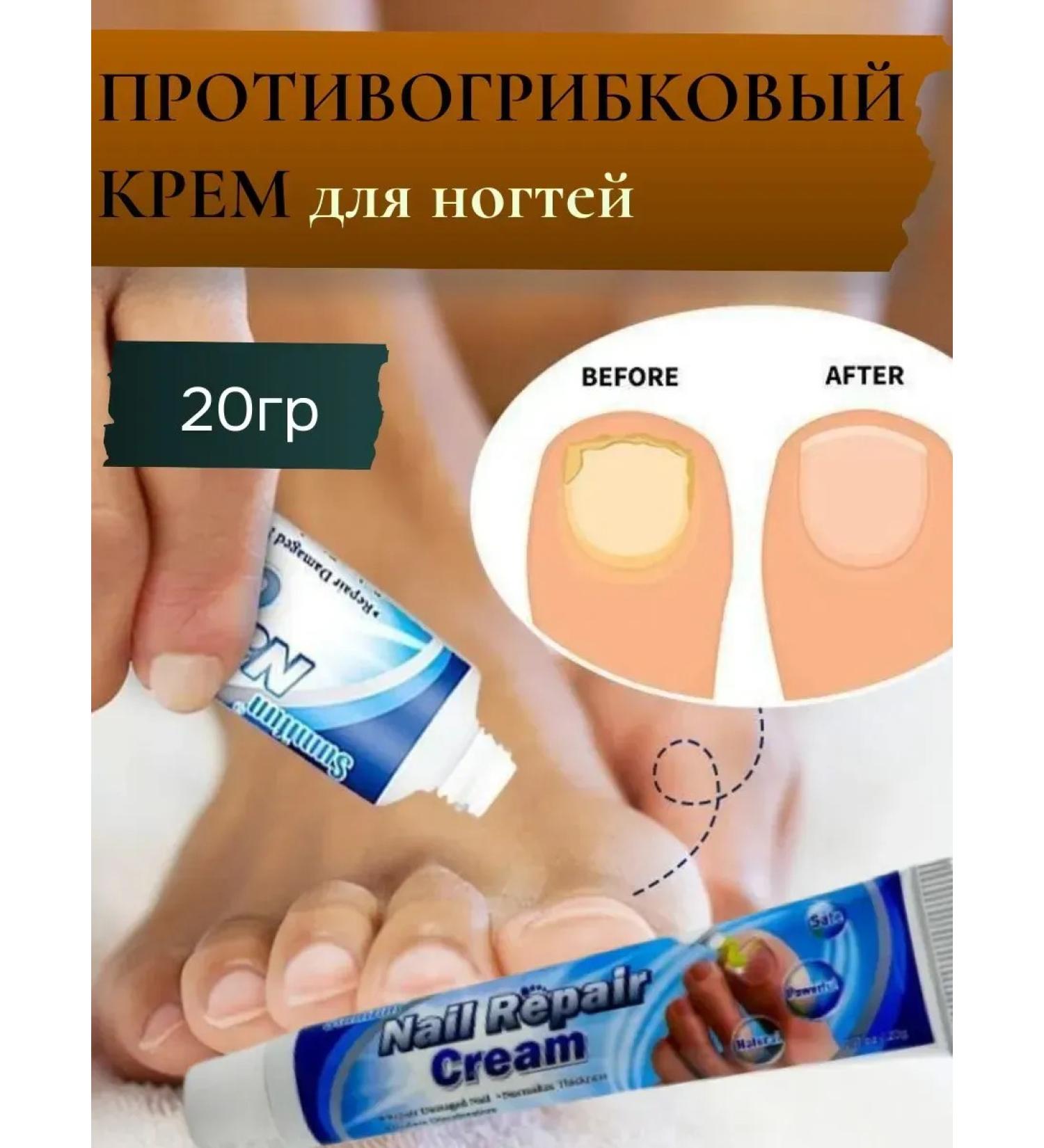 Chinese remedy for nail fungus - Buy Online on GoSupps.com