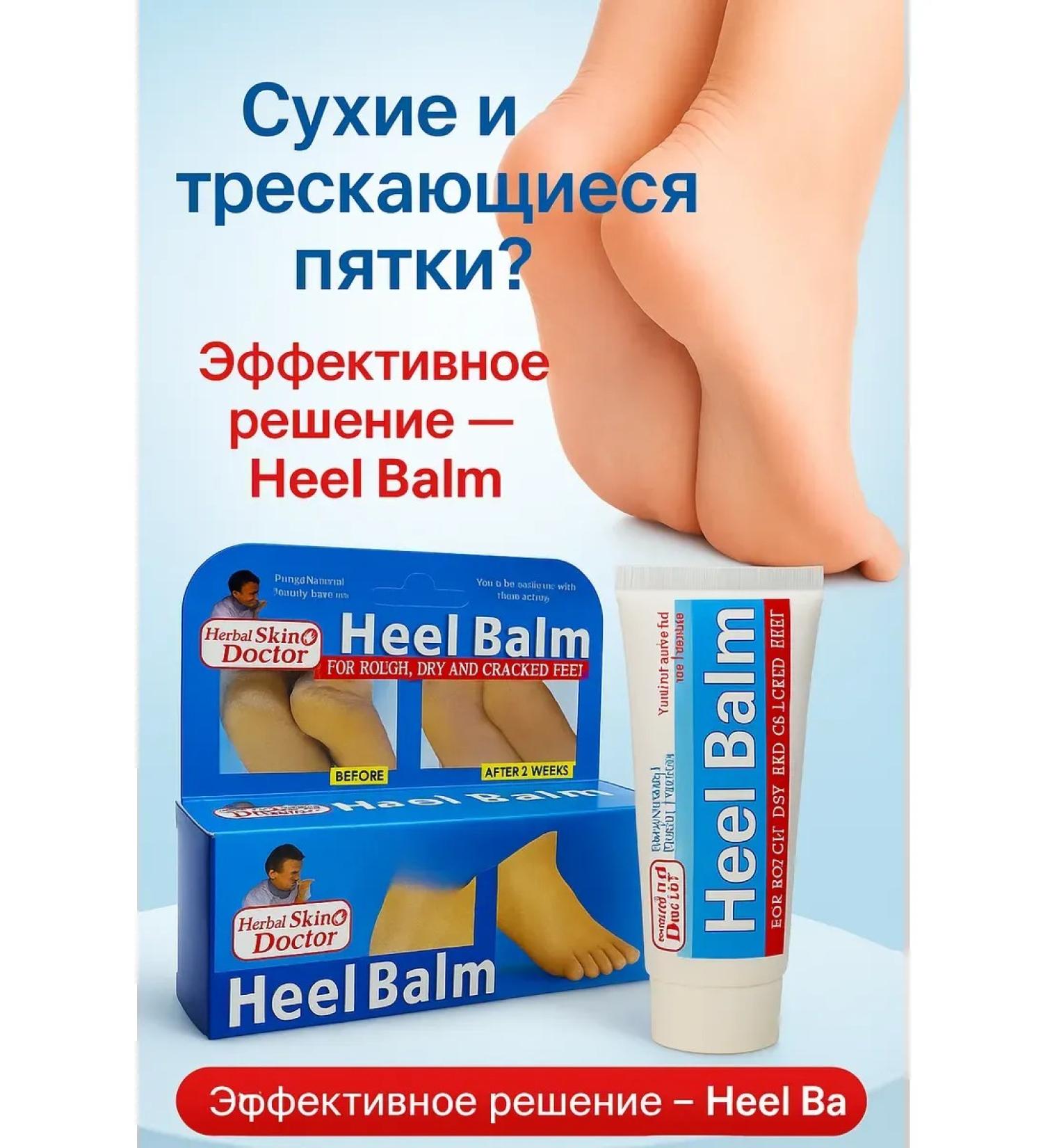 zozo Cream from cracks on heels - Buy Online on GoSupps.com