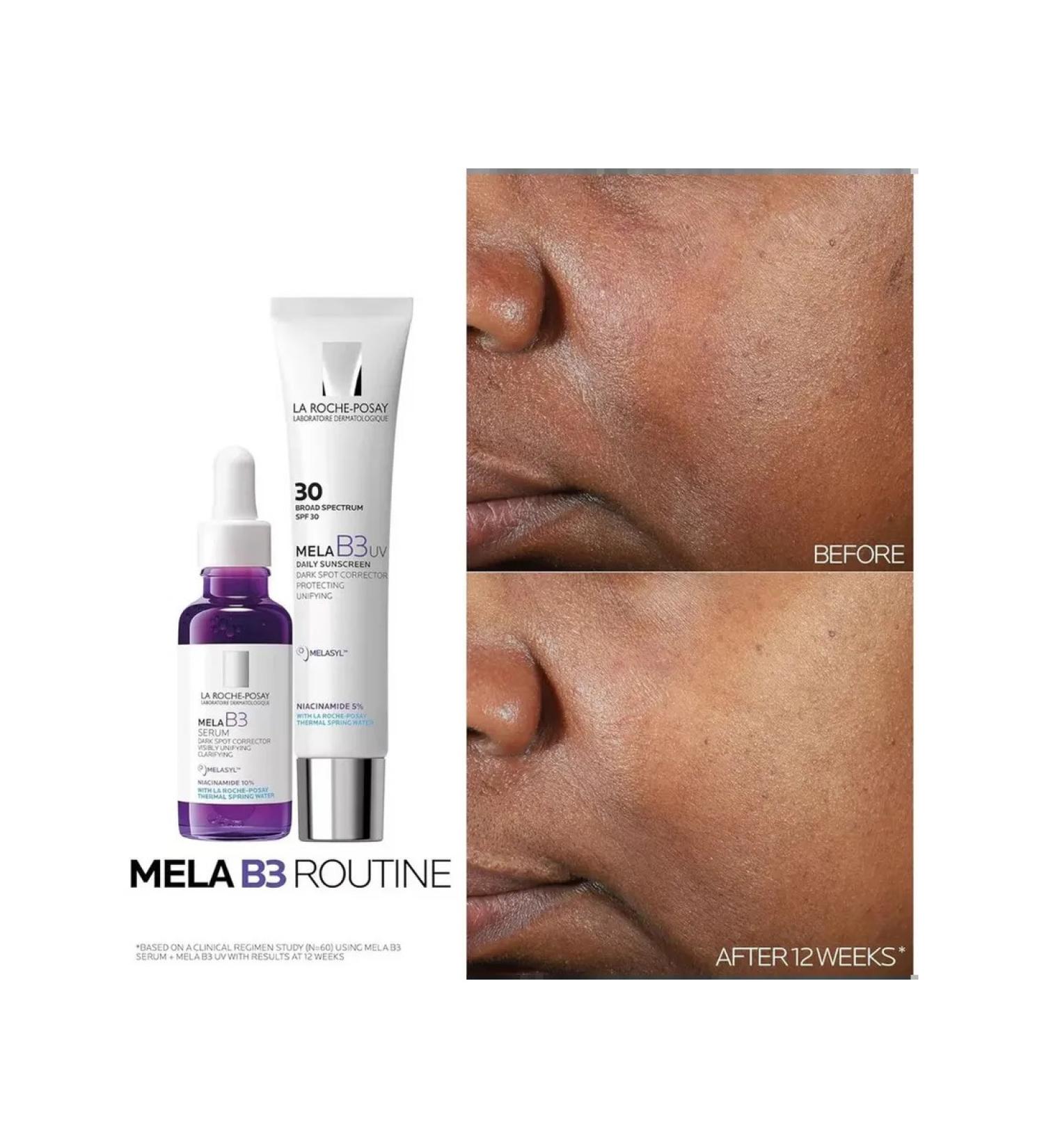 B3 Essence Dark Spots corrector - Buy Online on GoSupps.com