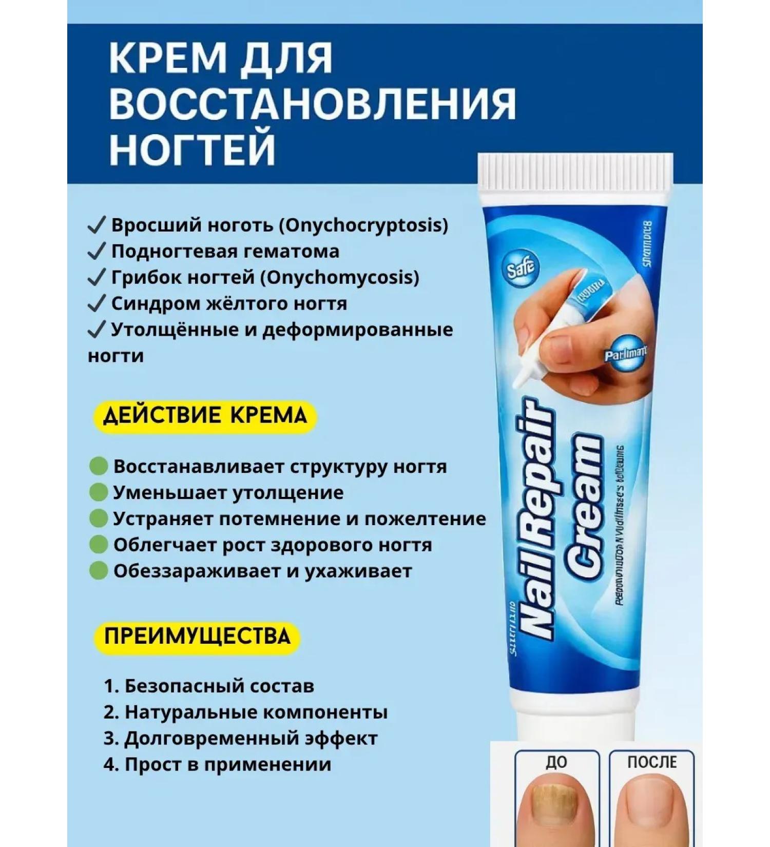 Teon Nail restoration cream antifungal - Buy Online on GoSupps.com
