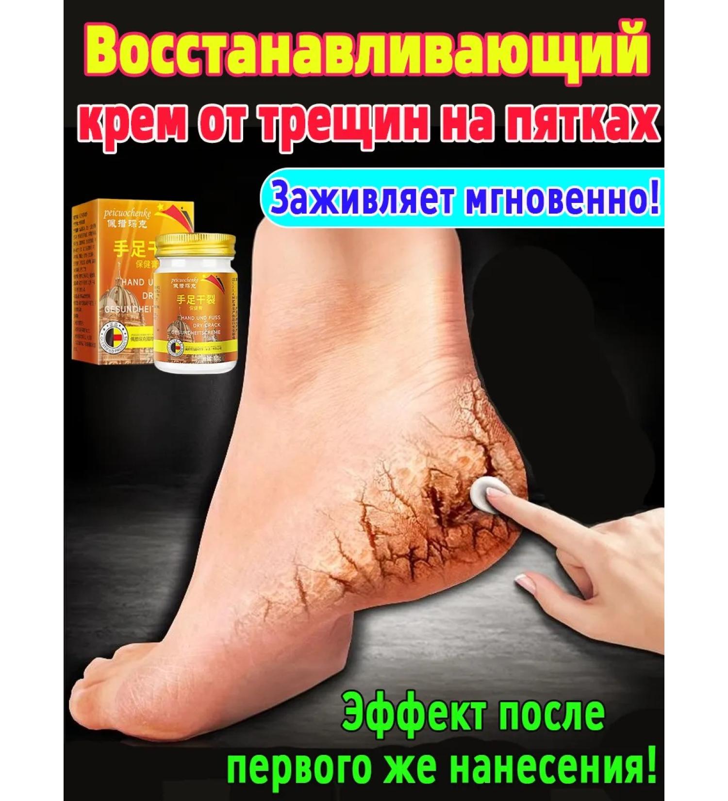 Cream from cracks on the heels healing 100r - Buy Online on GoSupps.com