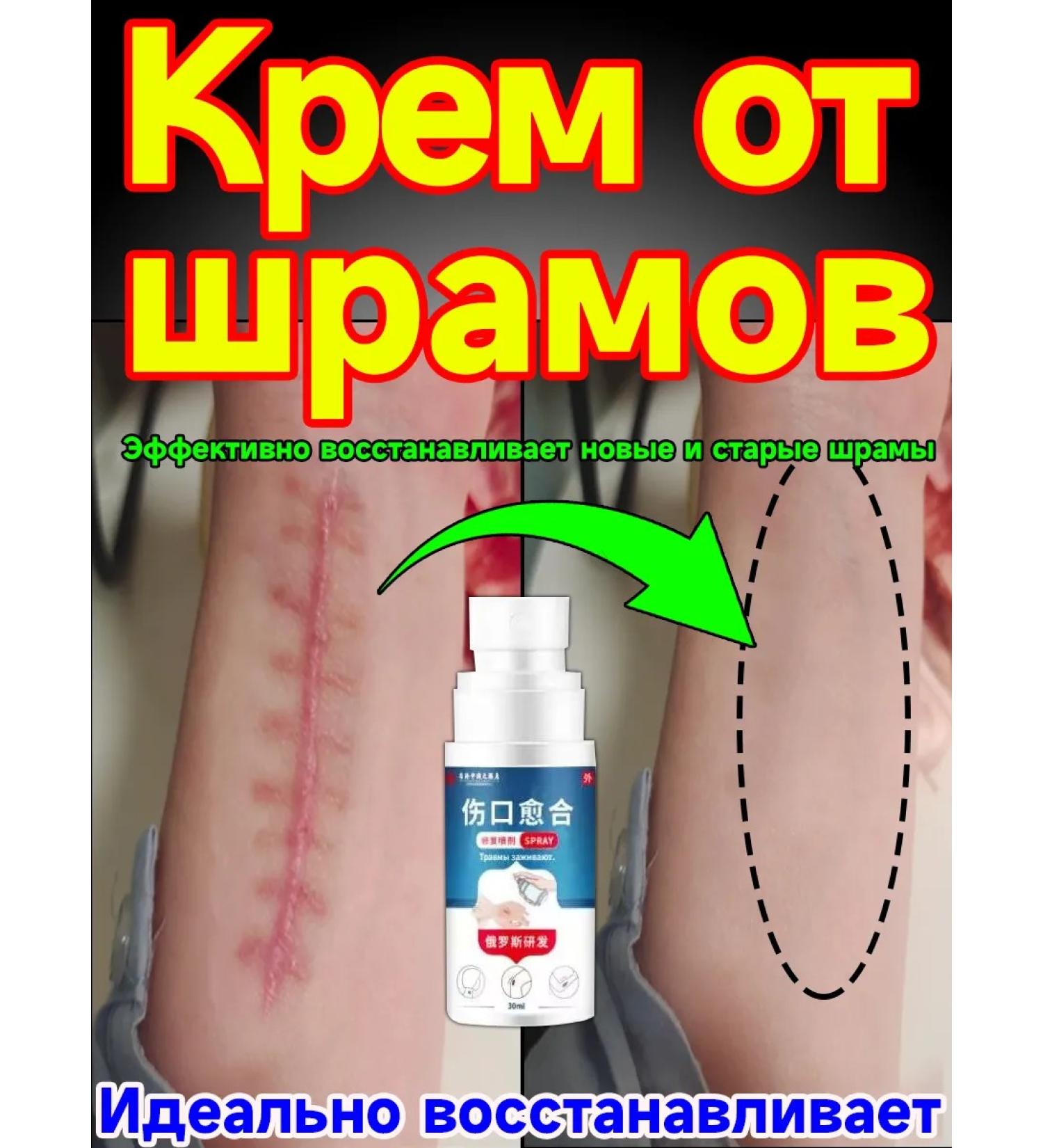 Cream gel from scars and scars of a post-acne burns on the face and body - Buy Online on GoSupps.com