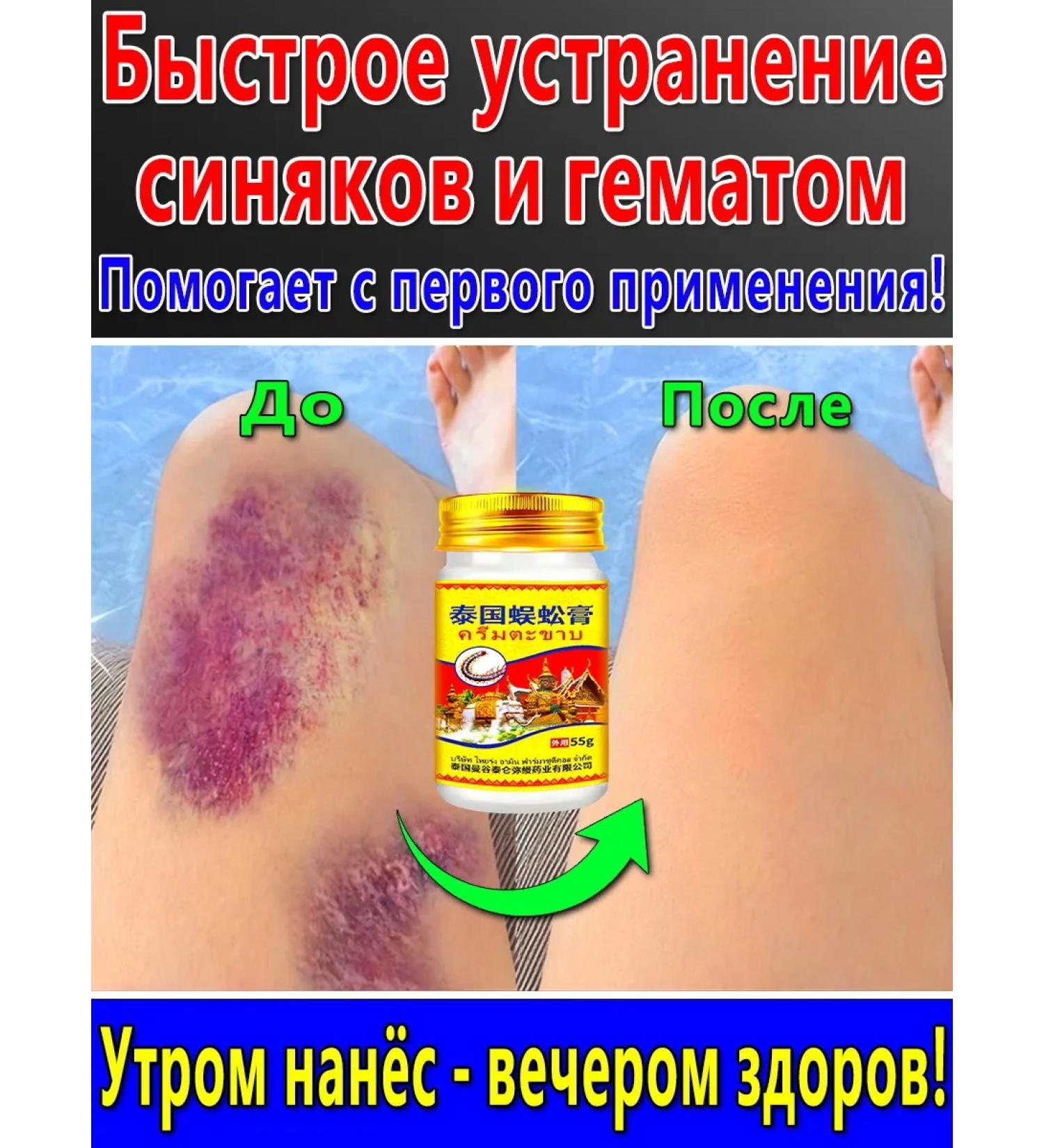 Ointment from bruises and hematomas on the body 30 r - Buy Online on GoSupps.com