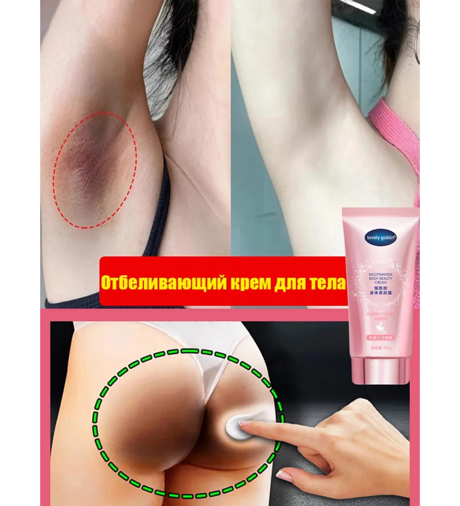 Whitening cream for an intimate area and armpits - Buy Online on GoSupps.com