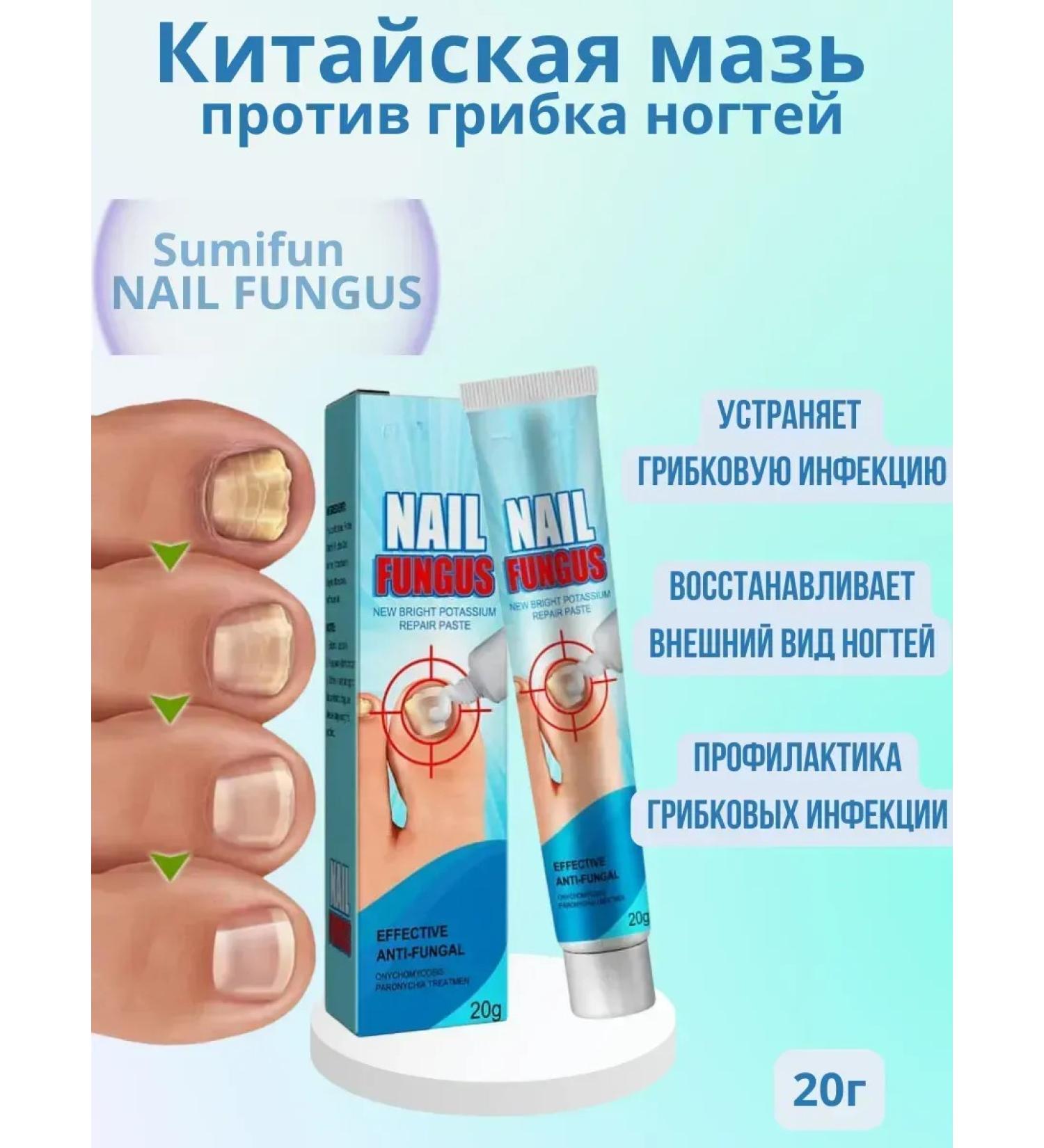 PREMIUM QUALITY N1 Chinese remedy for nail fungus antifungal cream - Buy Online on GoSupps.com