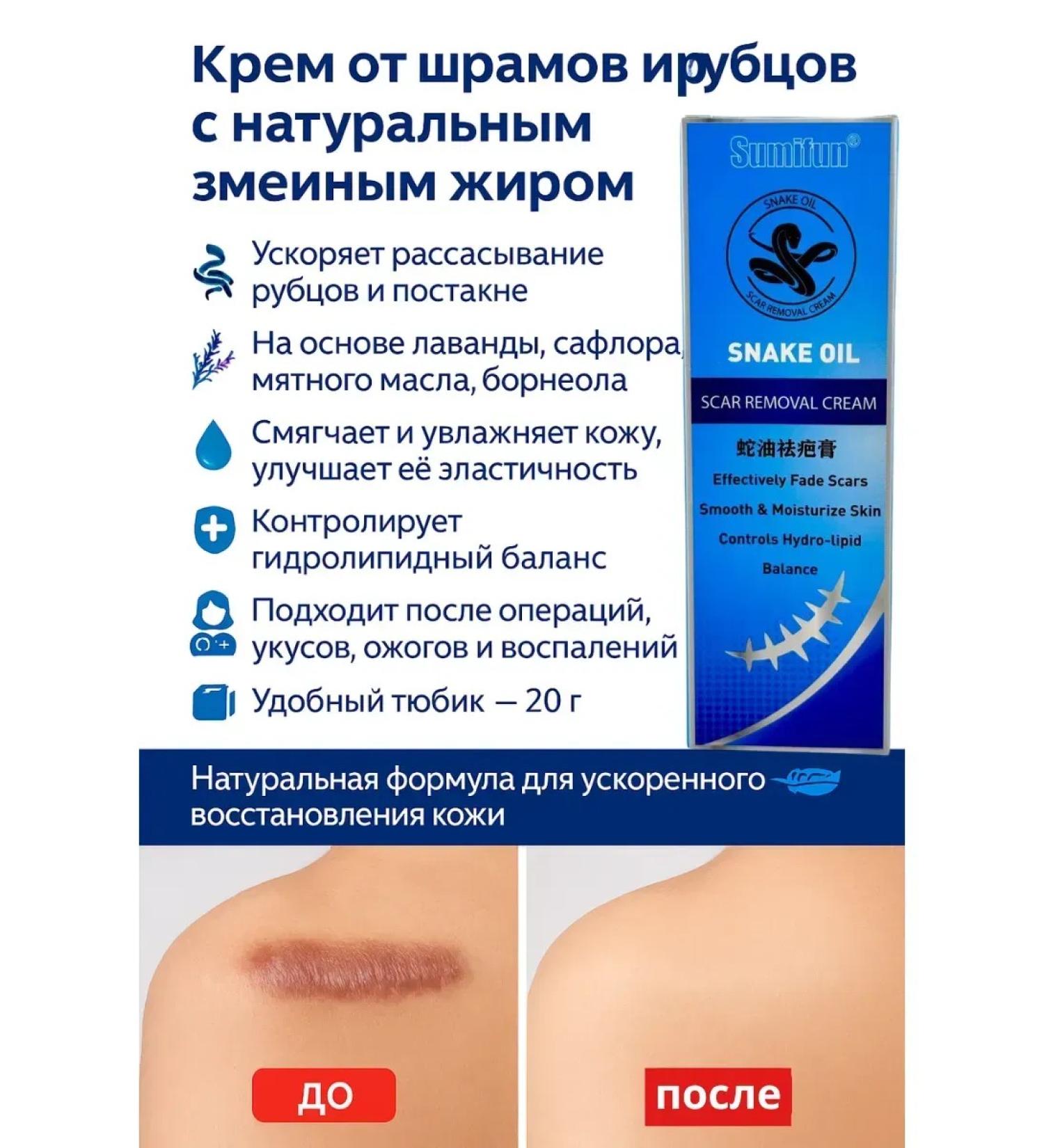 Life Cream ointment from scars scars stretch marks post -acne after burns - Buy Online on GoSupps.com