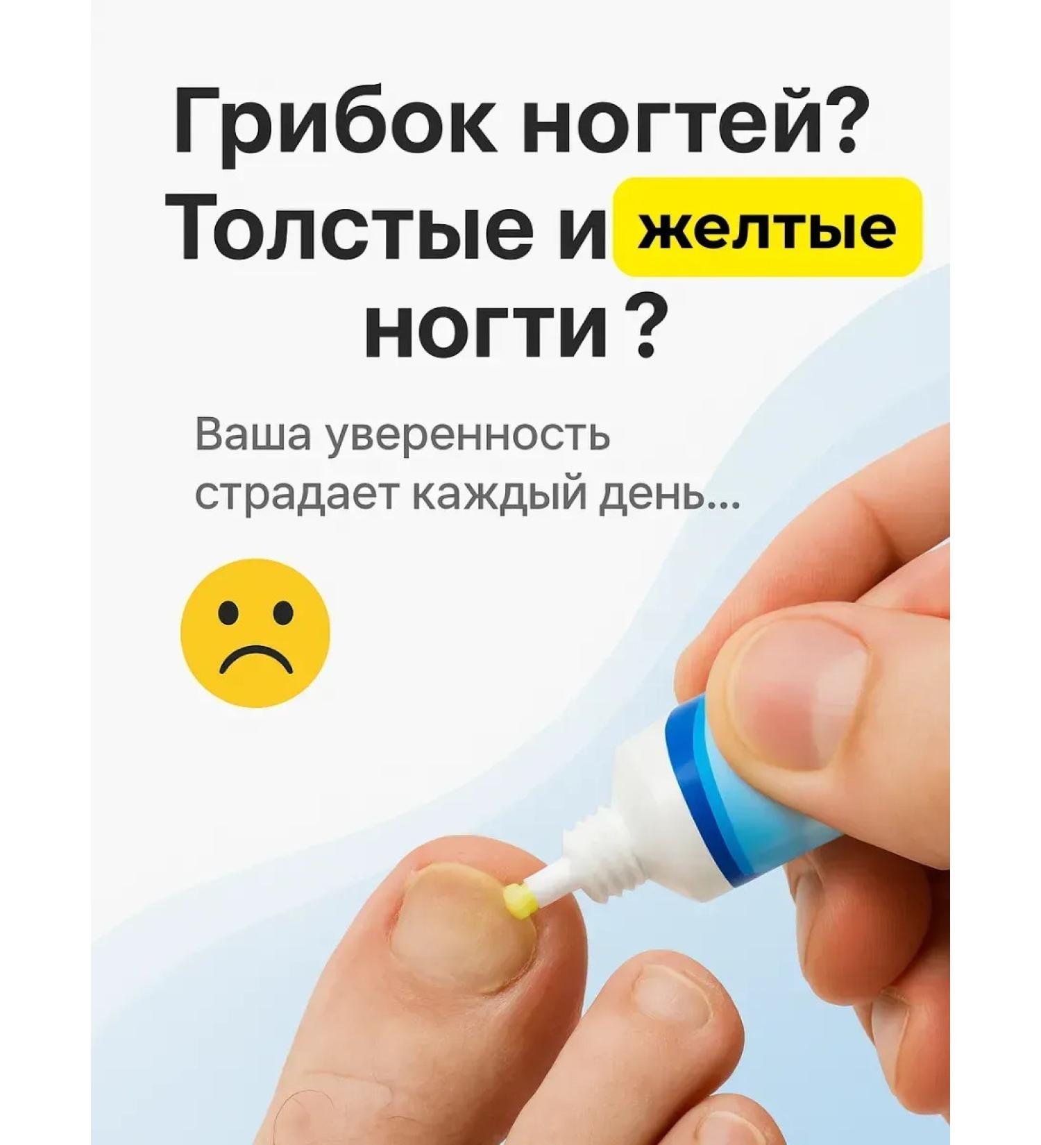 Welcome 1 Cream for nail treatment - Buy Online on GoSupps.com