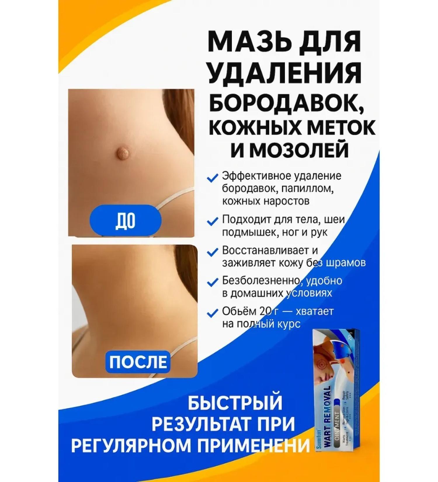 Life cream ointment from warts and papillomas from skin growths - Buy Online on GoSupps.com