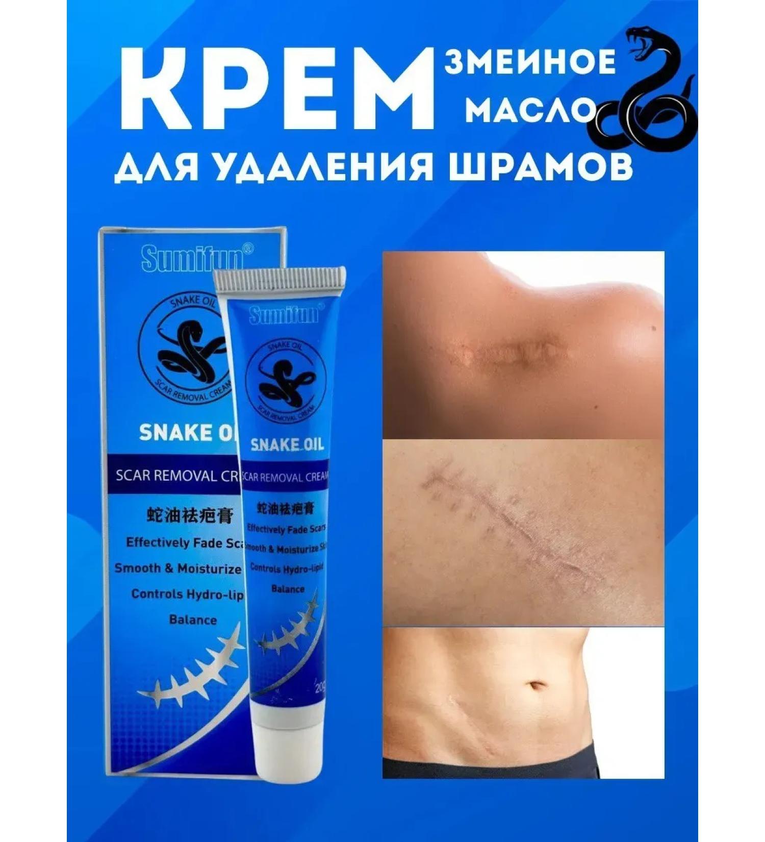 DASTAN2 Cream for removing scars - Buy Online on GoSupps.com