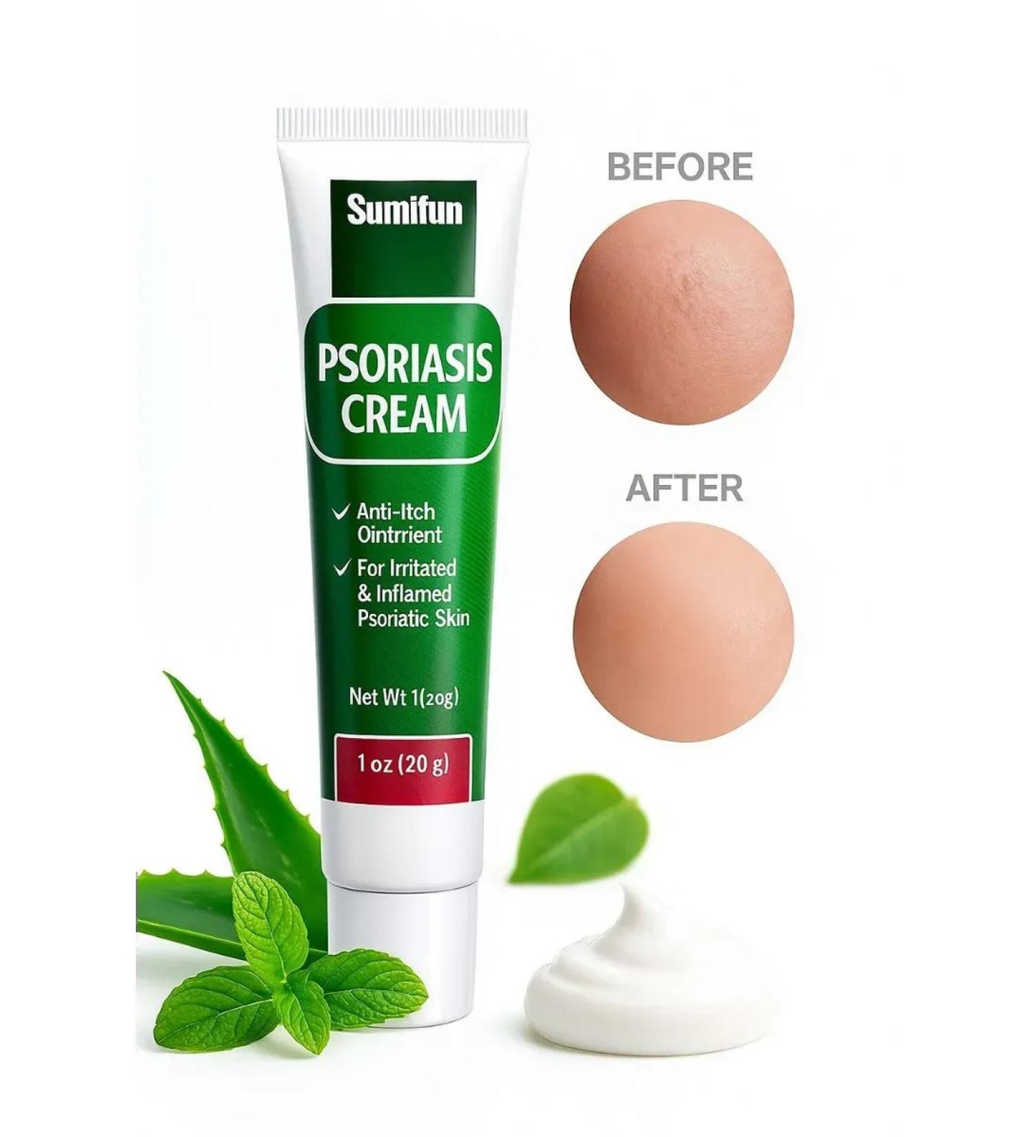 Narmina Cream from psoriasis Chinese Sumifun - Buy Online on GoSupps.com