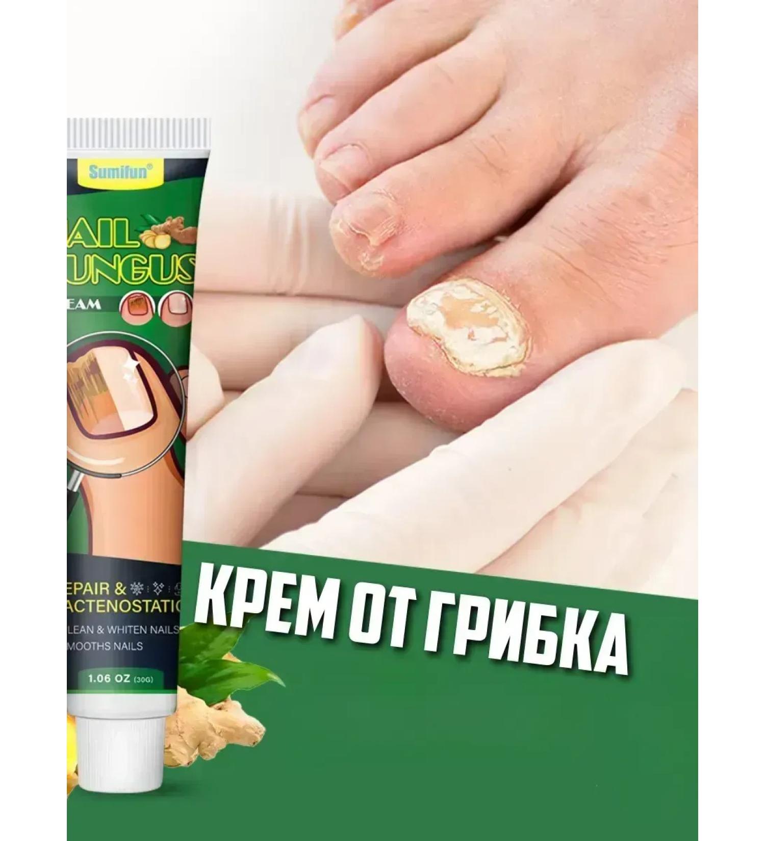 KazBrand ointment from the fungus on the nails - Buy Online on GoSupps.com