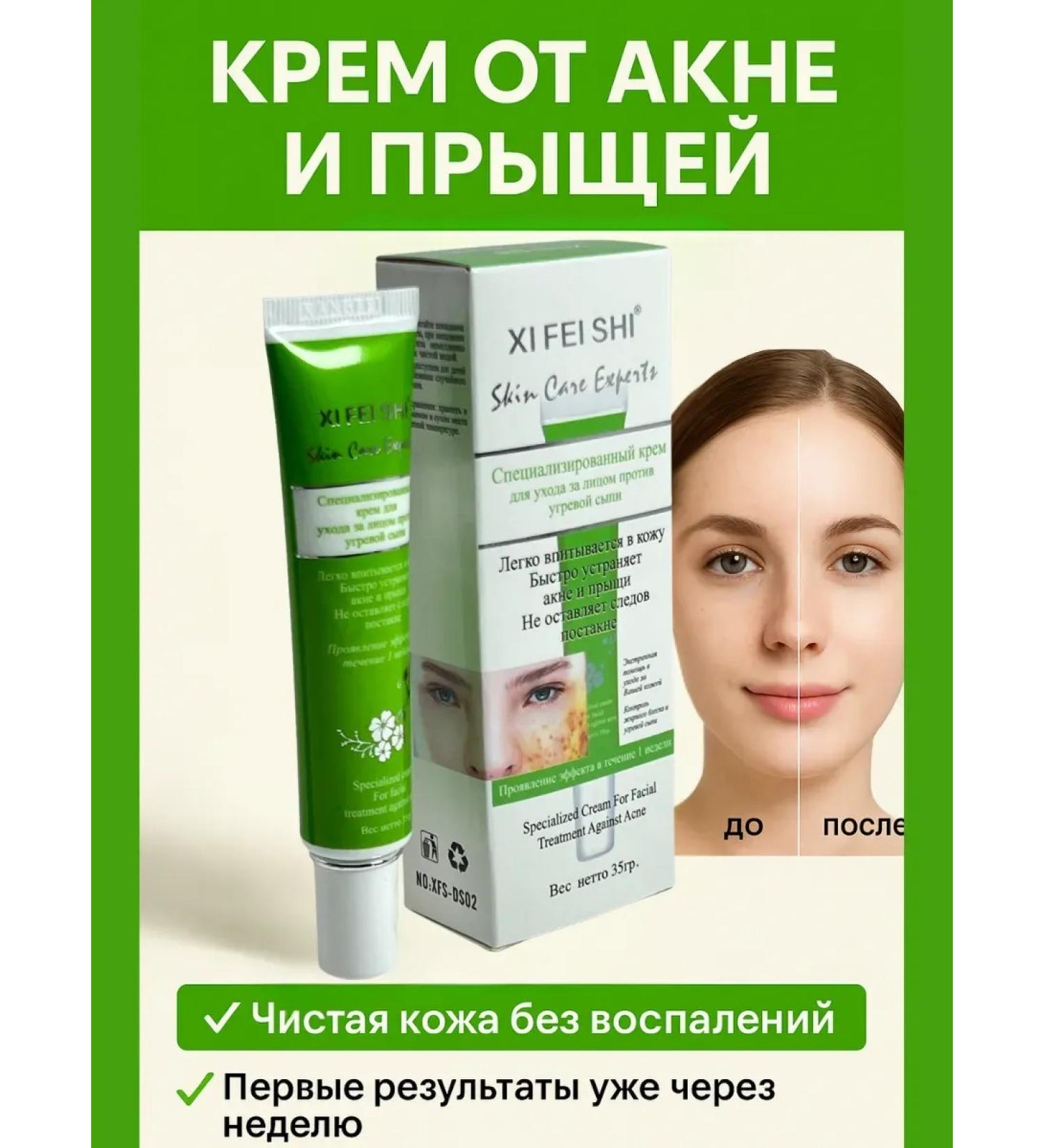 SanSafGoods Acne and acne cream - Buy Online on GoSupps.com