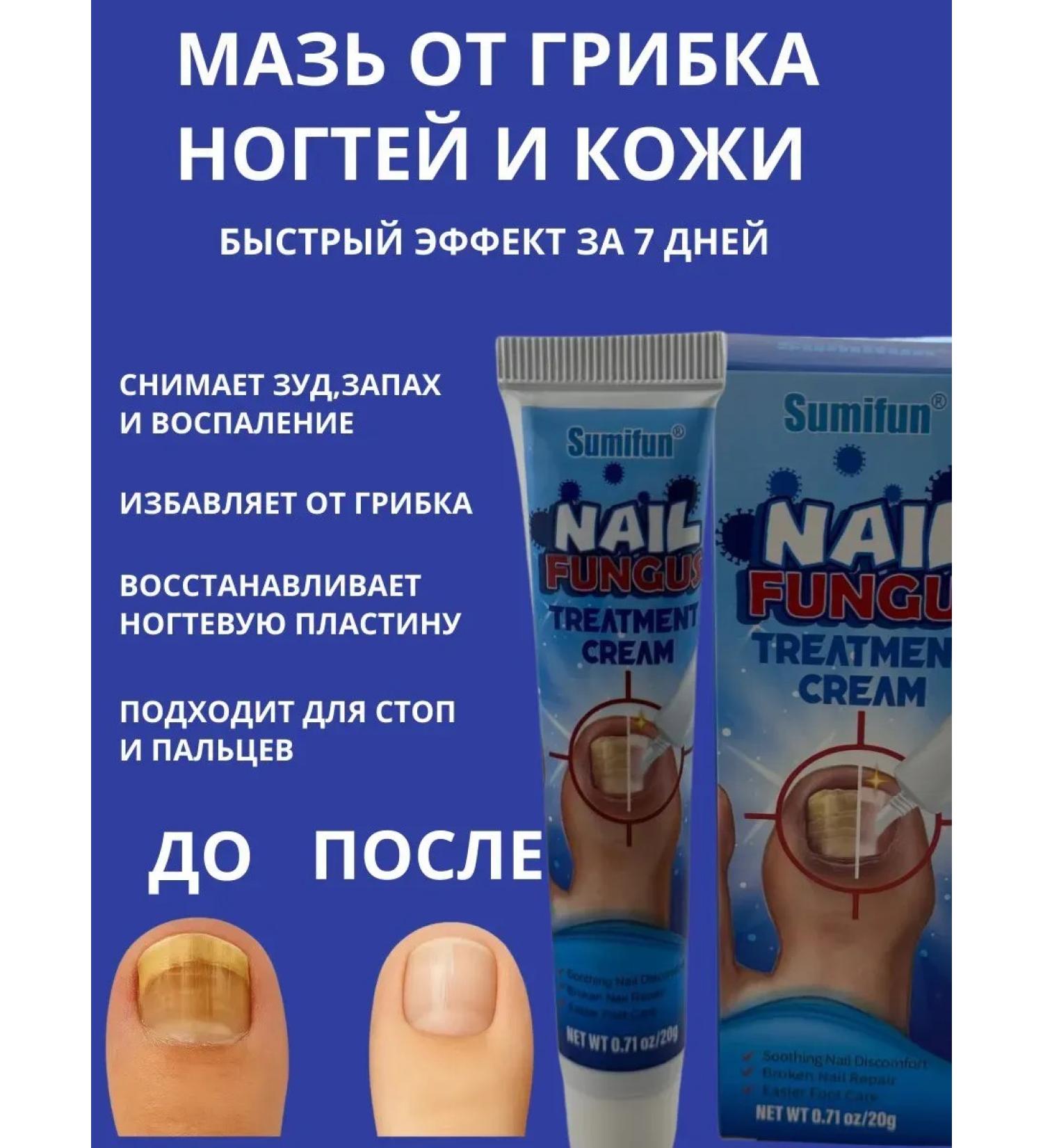 IMC Highly effective antifungal nail ointment - Buy Online on GoSupps.com
