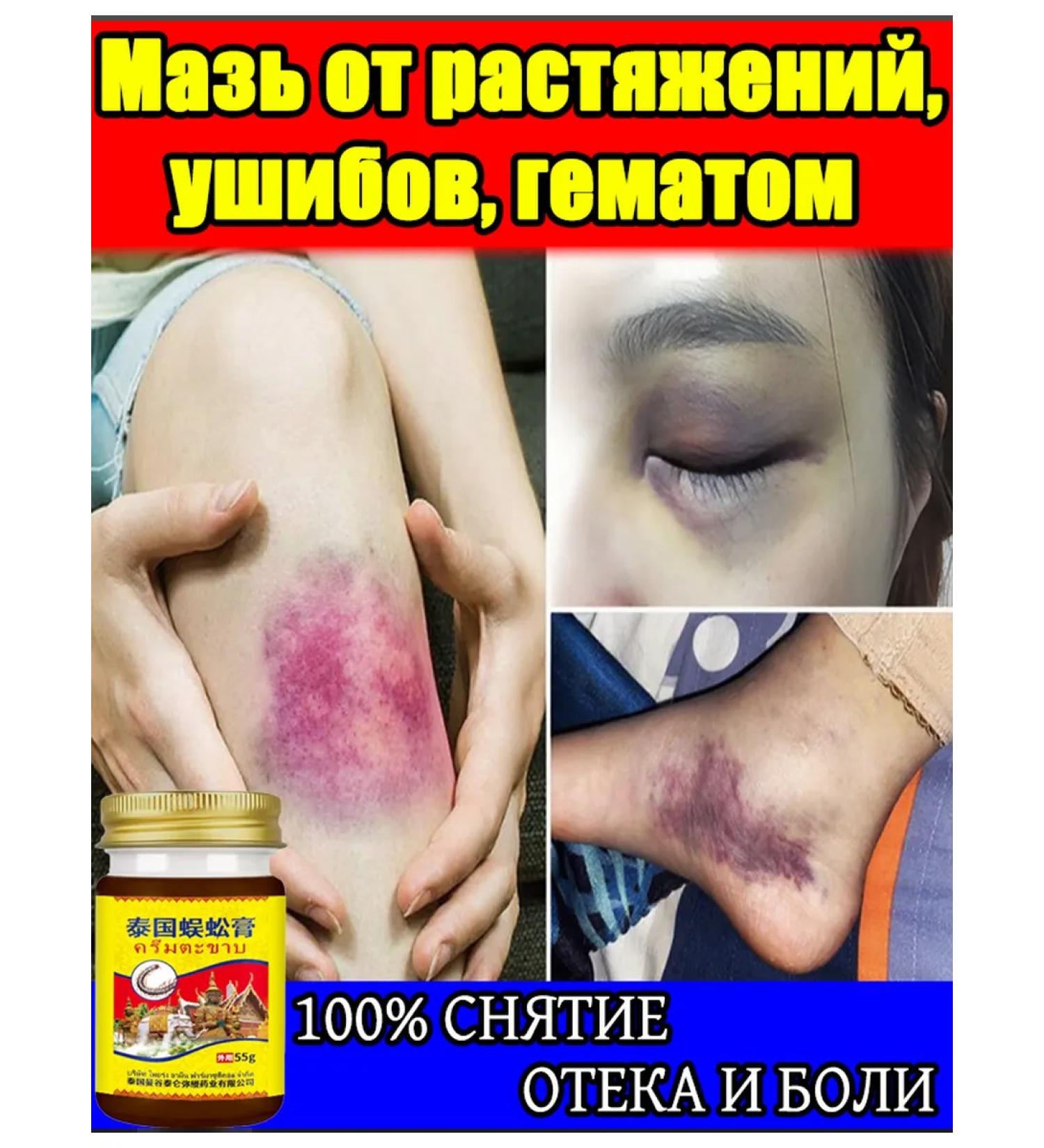 Ointment from bruises and sprains with anesthetic 110 ml - Buy Online on GoSupps.com