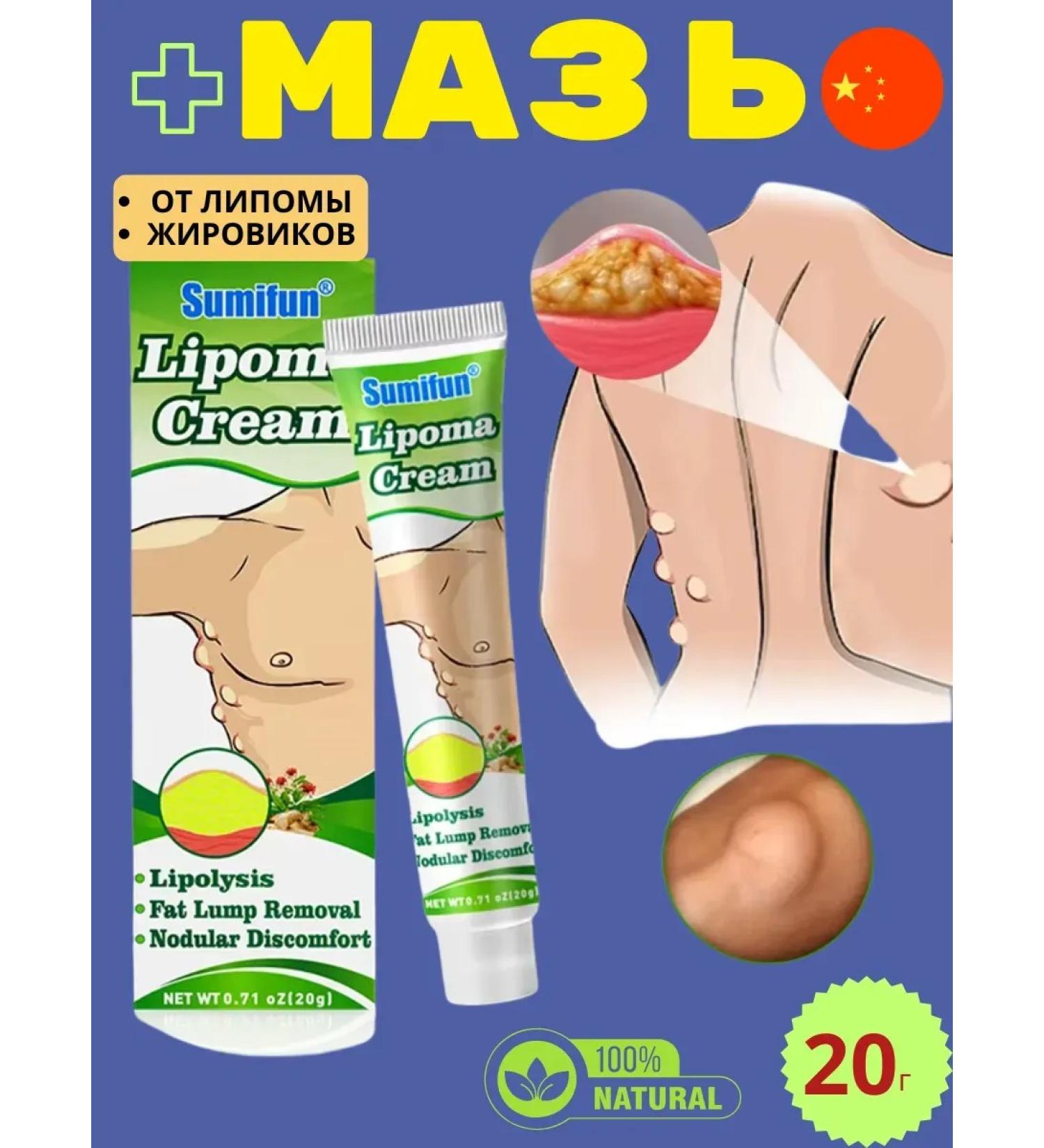 adellemix Ointment from lipoma wen and tumors of Chinese - Buy Online on GoSupps.com