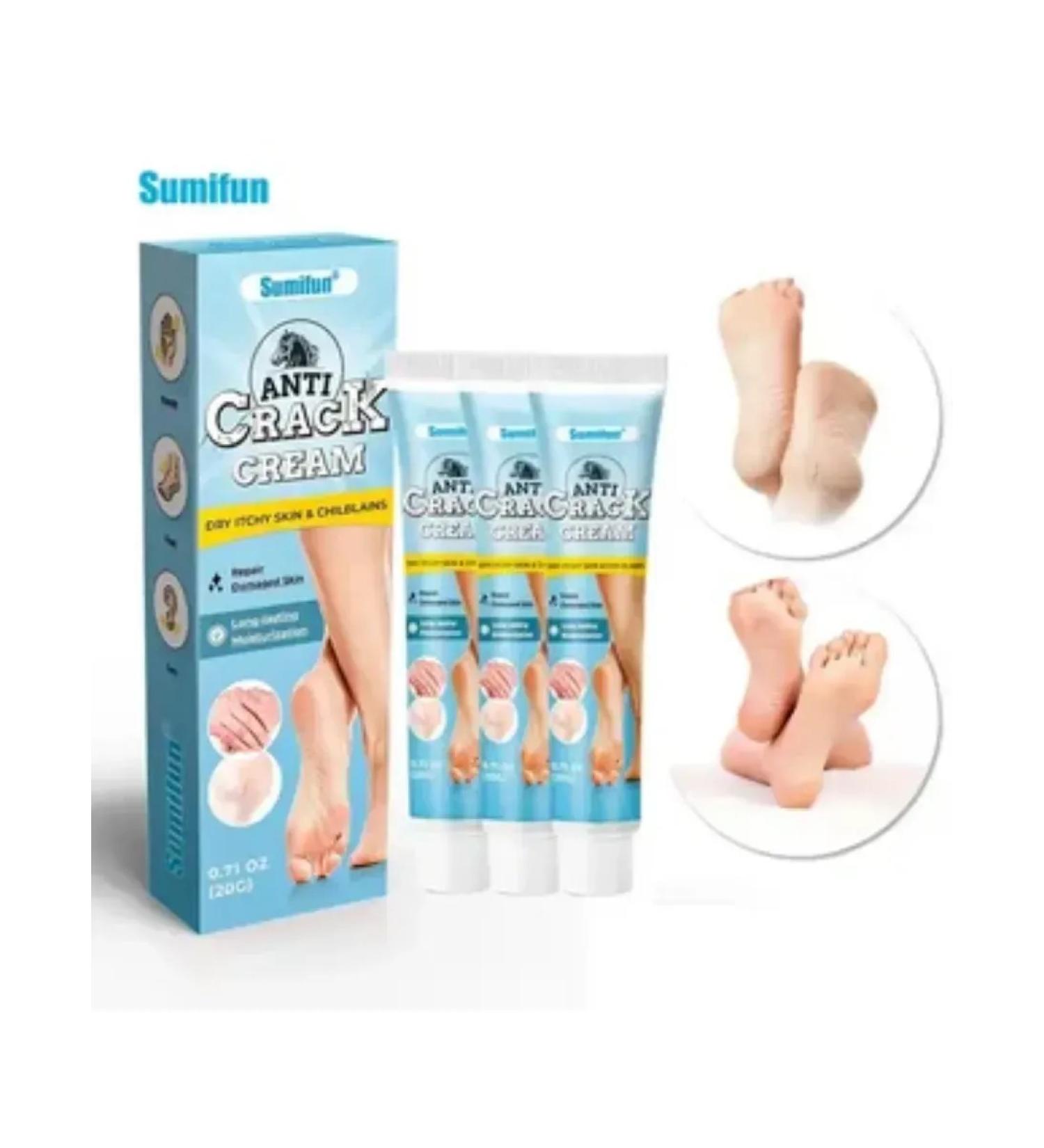 kupiDa Anti-Cream for Hands and Legs