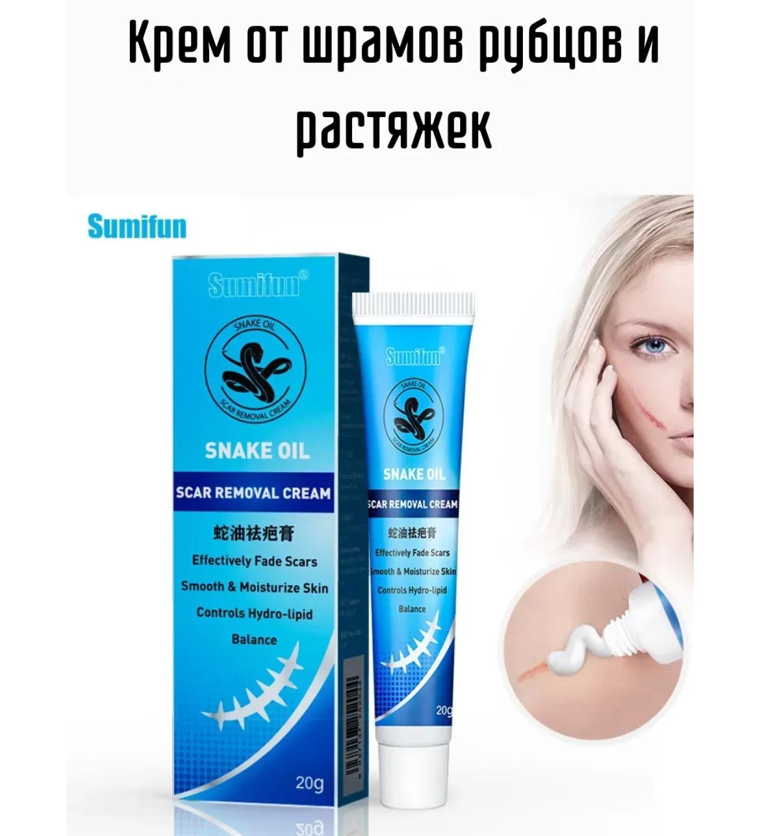 KEVO Cream against scars scars and stretch marks regenerating - Buy Online on GoSupps.com