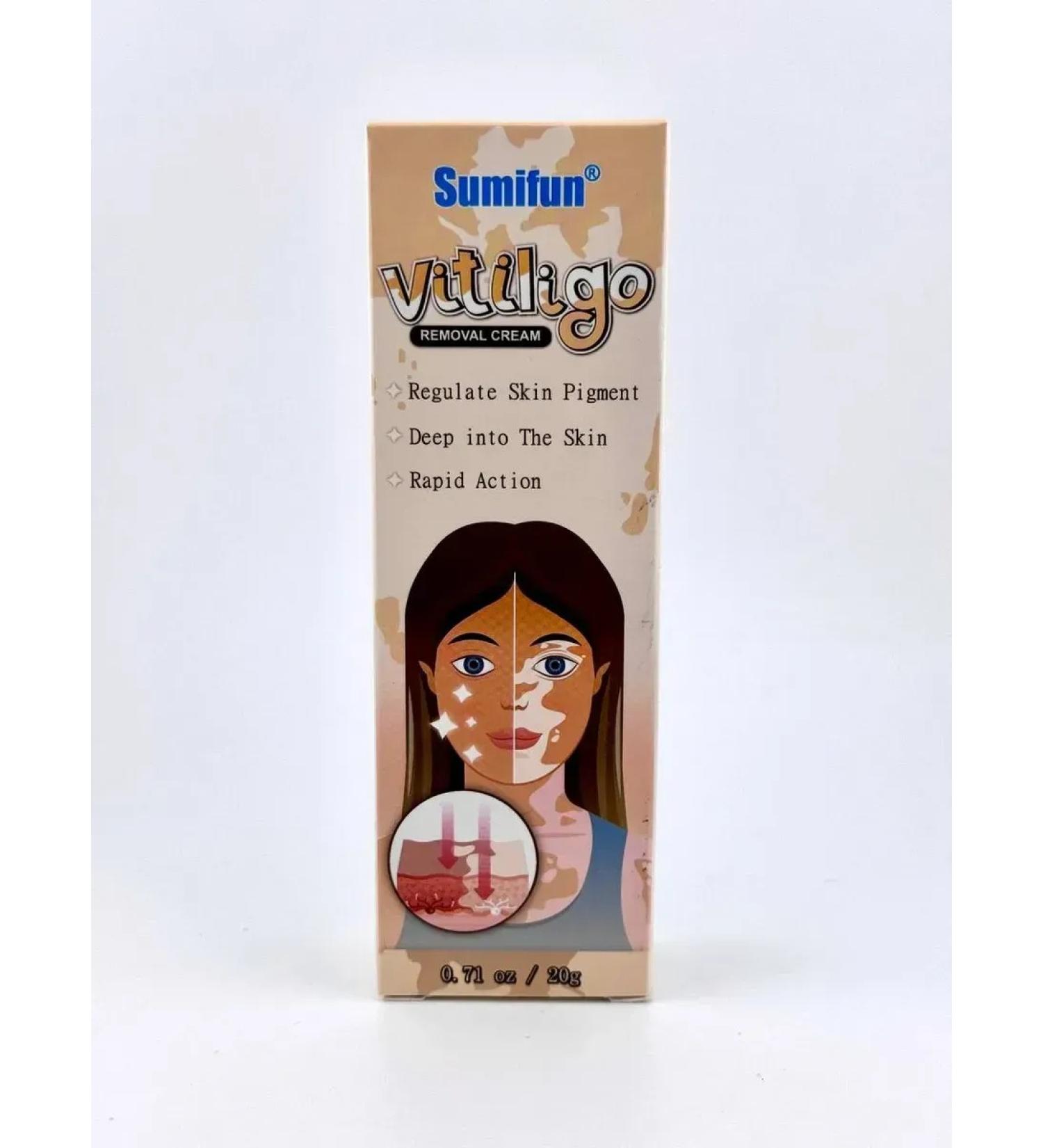 ACTIVITY Vitiligo cream natural - Buy Online on GoSupps.com