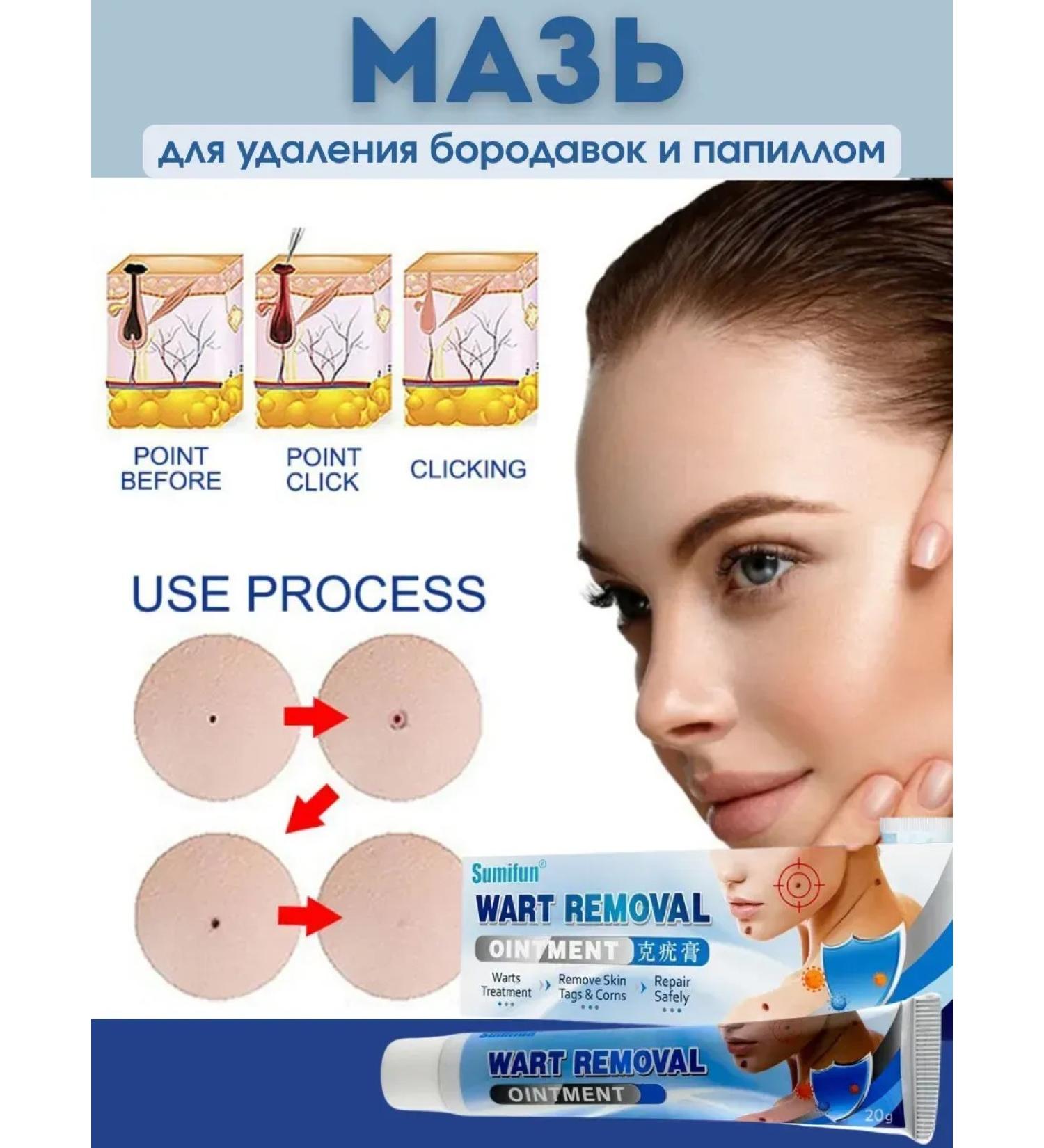 Welcome 1 Cream for removing warts and papilloma celandine - Buy Online on GoSupps.com