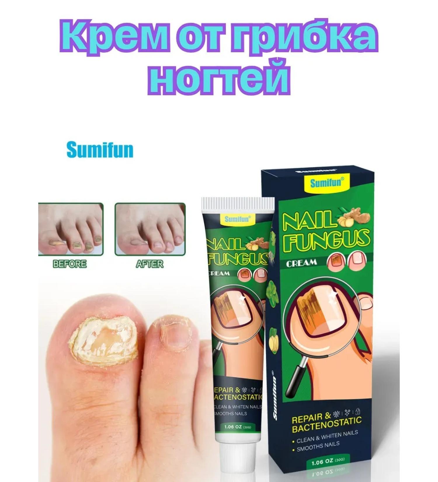 KEVO Miracle cream from nail fungus - Buy Online on GoSupps.com