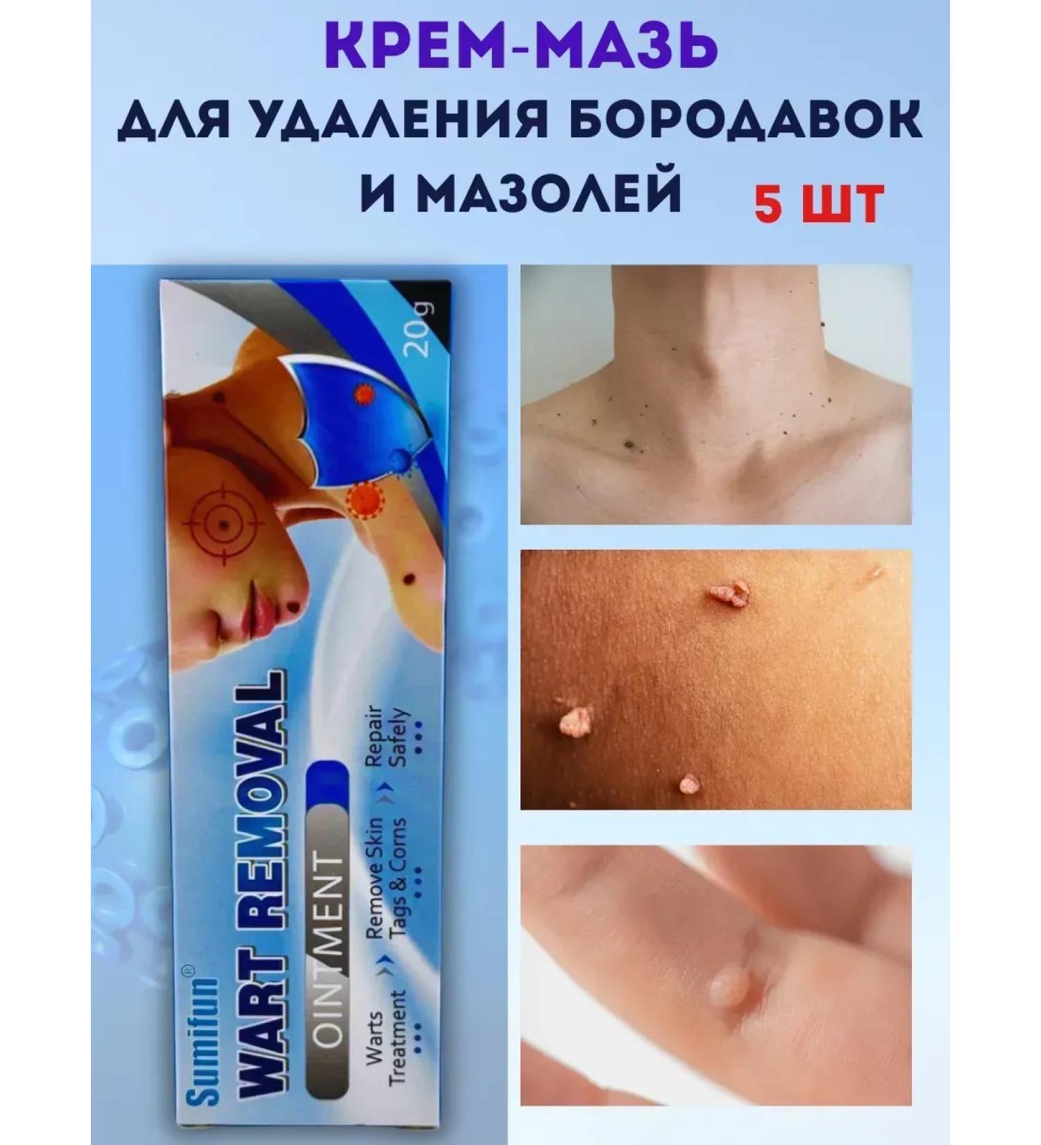 Kalis Cream for removing warts masols and papillomas 5pcs - Buy Online on GoSupps.com