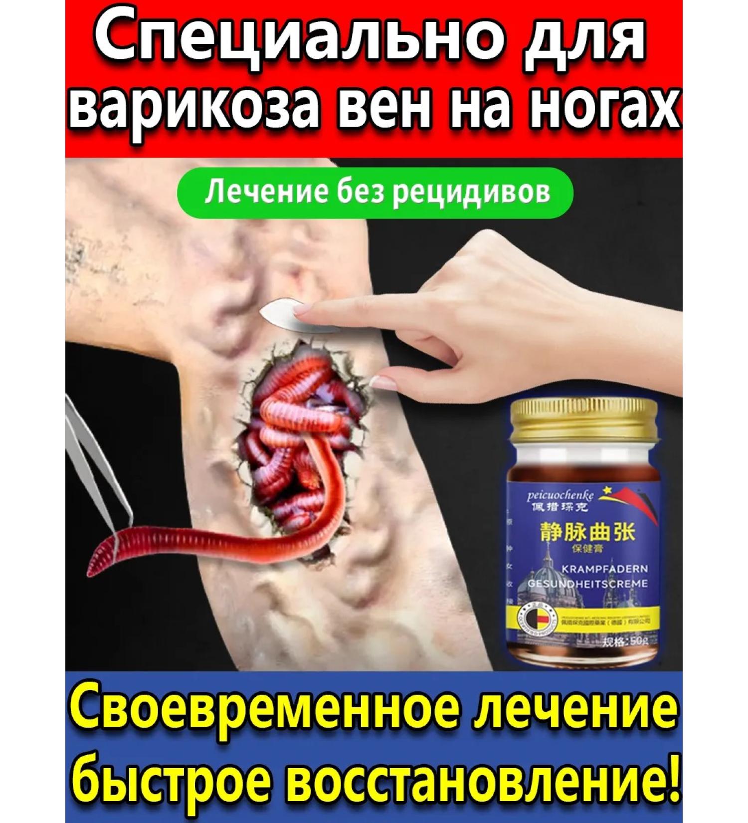 ointment from varicose veins on the legs - Buy Online on GoSupps.com