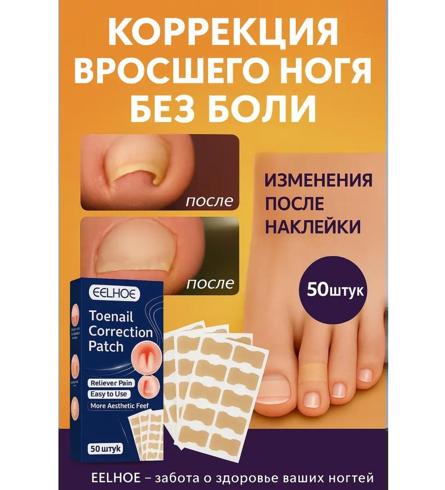 MELUX Plaster for the correction of ingrown nails on the legs - Buy Online on GoSupps.com